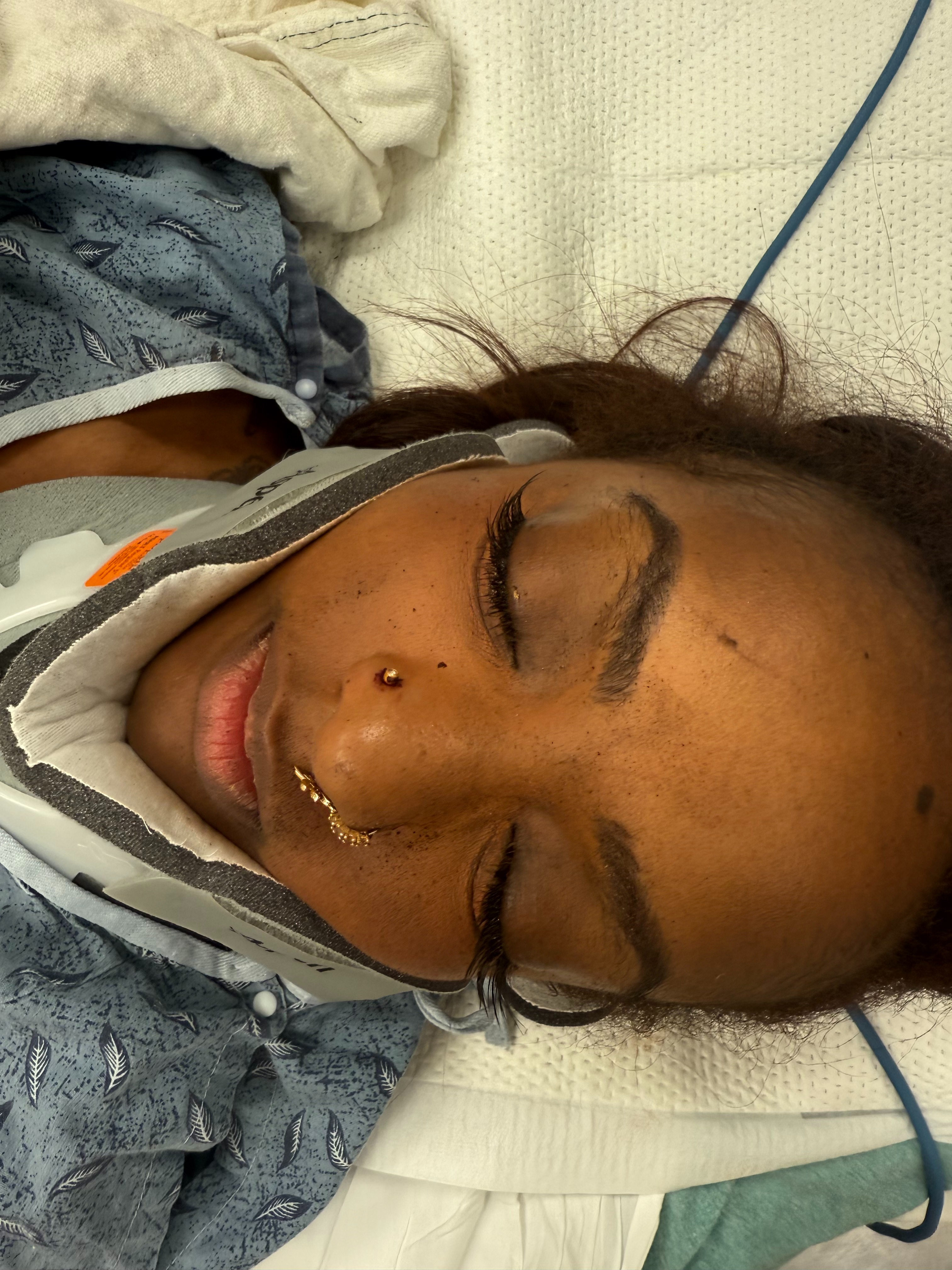 Help Ohso With Medical Bills After Hit-and-Run Accident campaign photo, 4 of 4