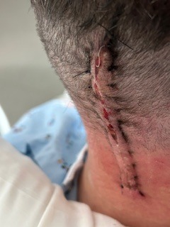 Support Jon Boy’s brain surgery recovery campaign photo, 2 of 8