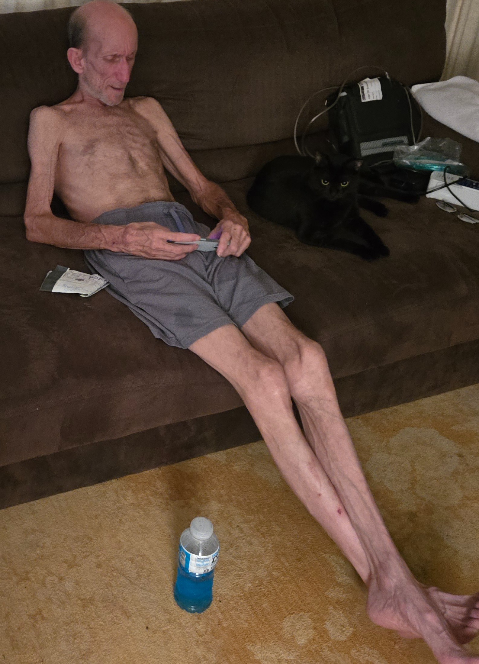 Help William Turner Live. Please Share. campaign photo, 2 of 5