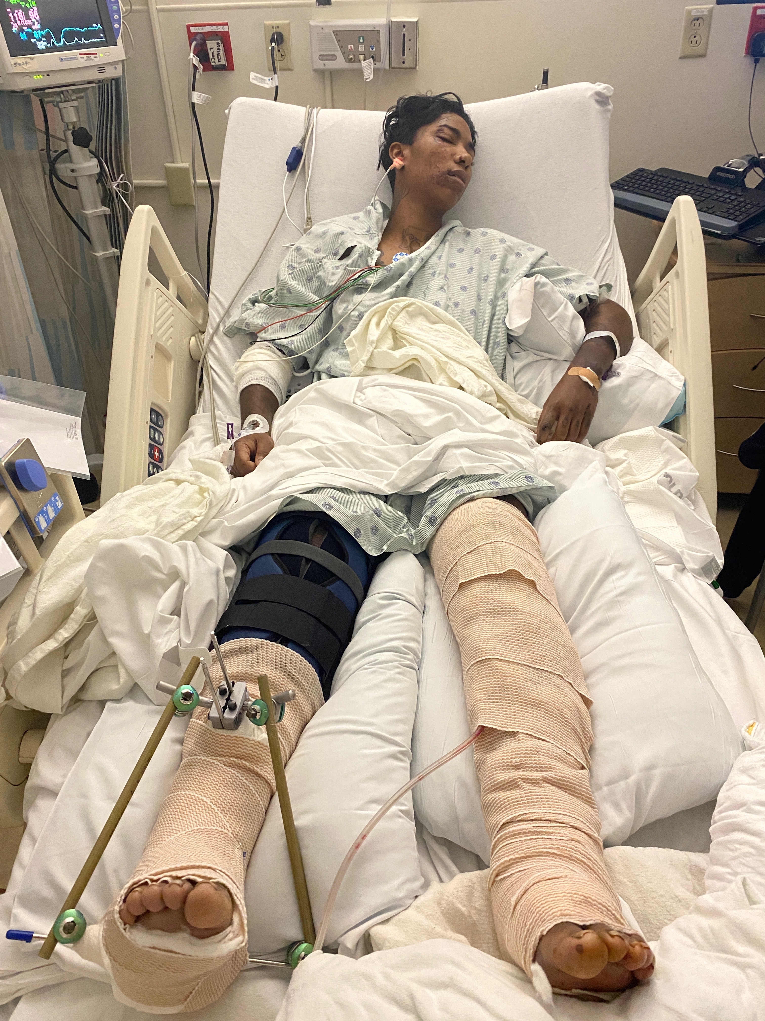 Support Jessica’s Recovery After Accident campaign photo, 5 of 7