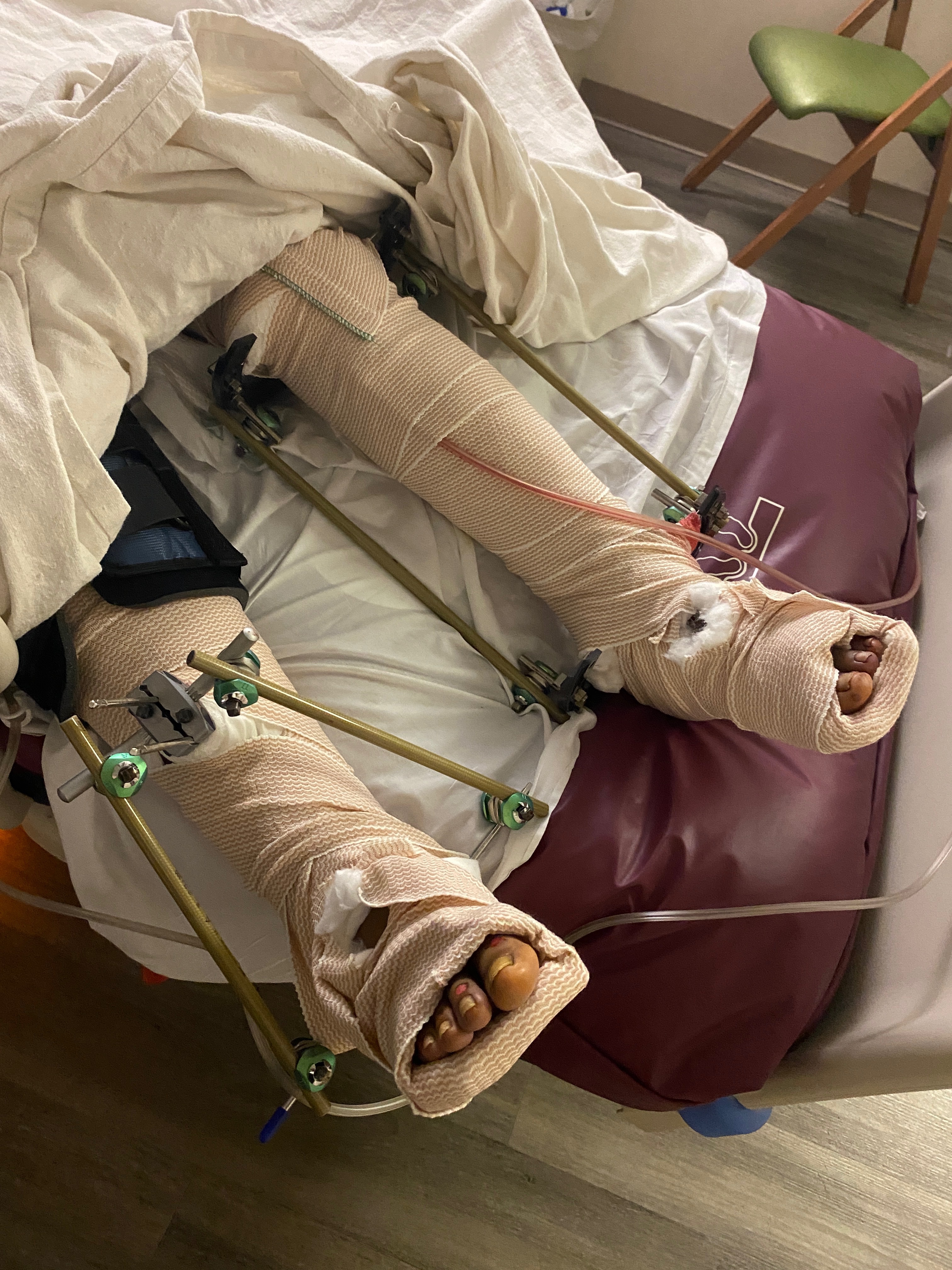 Support Jessica’s Recovery After Accident campaign photo, 2 of 7