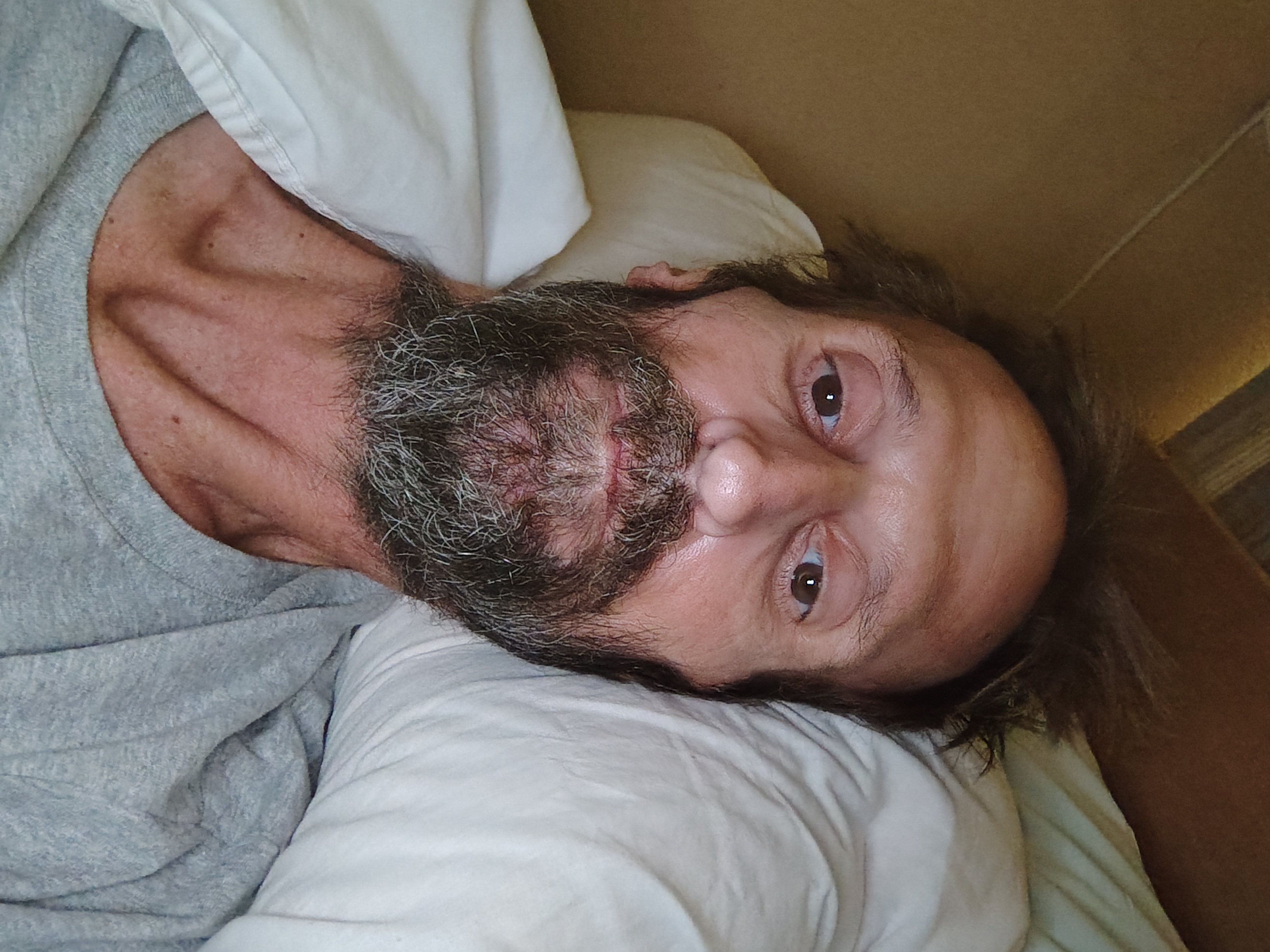 Life changing major surgery (lleostomy)(Crons) campaign photo, 2 of 4