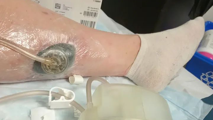 UPDATE! Damsel in Distress!! Wound& Plastics Clinic photo