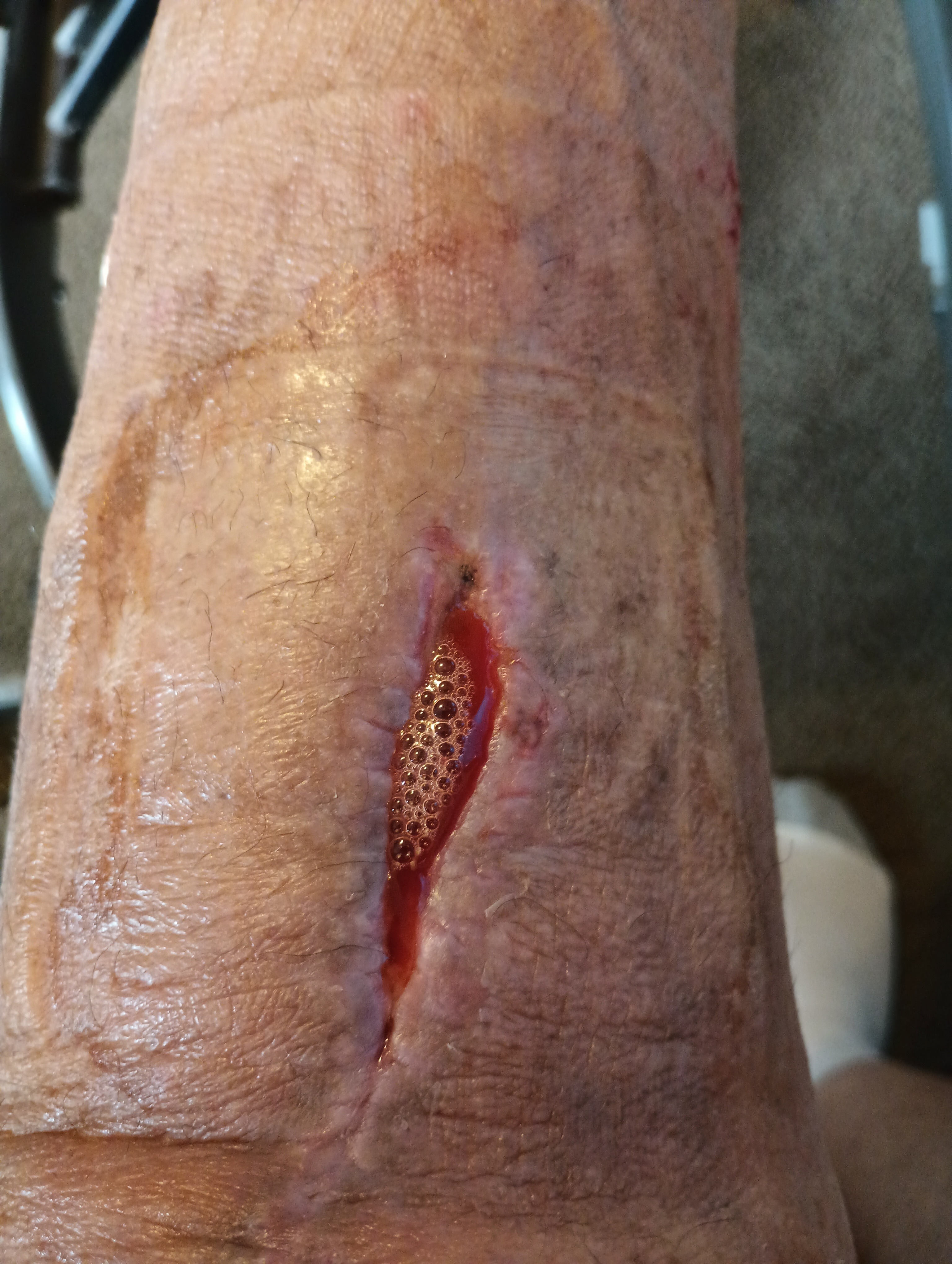Support Julius James Ebrom's Medical Bills & Living Expenses campaign photo, 2 of 8