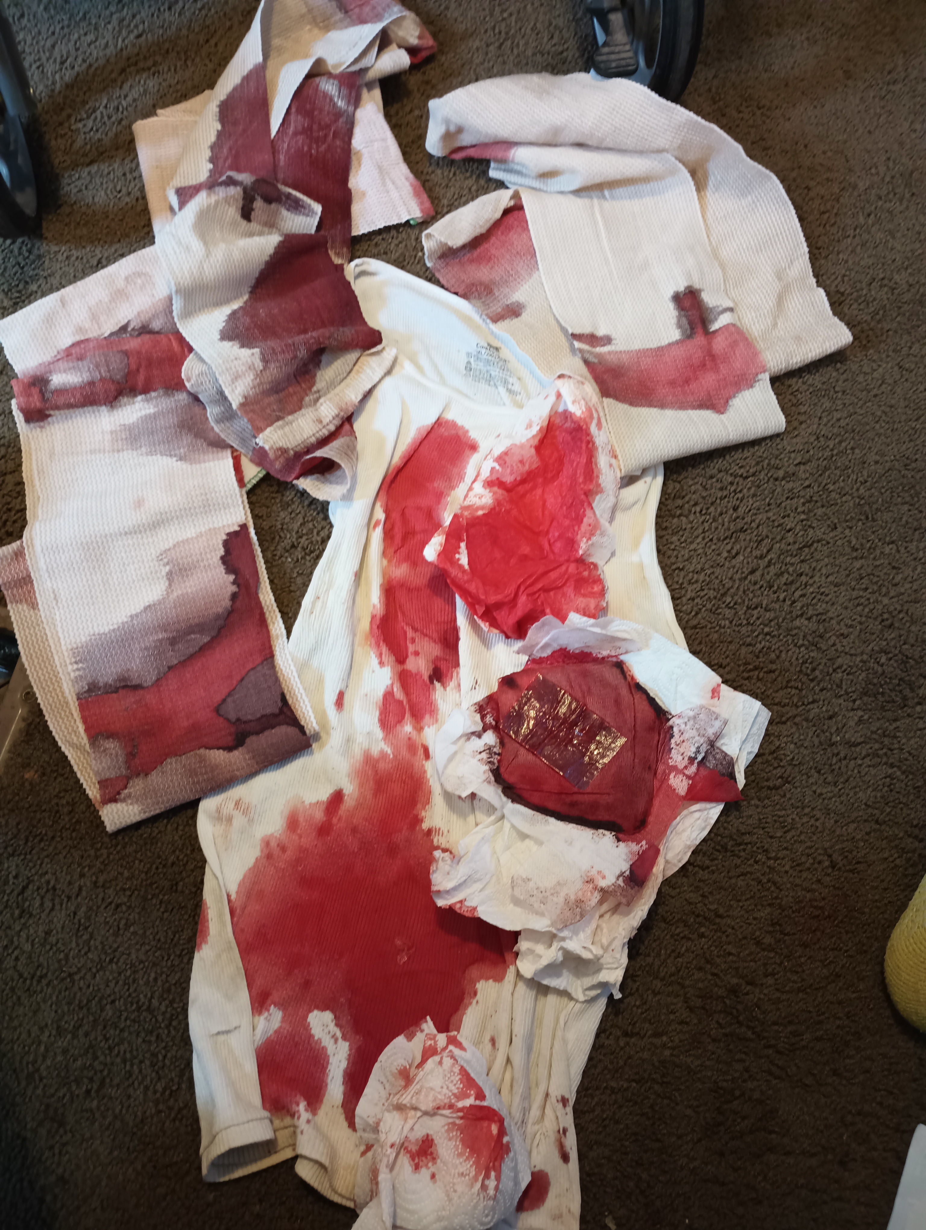 Support Julius James Ebrom's Medical Bills & Living Expenses campaign photo, 4 of 8