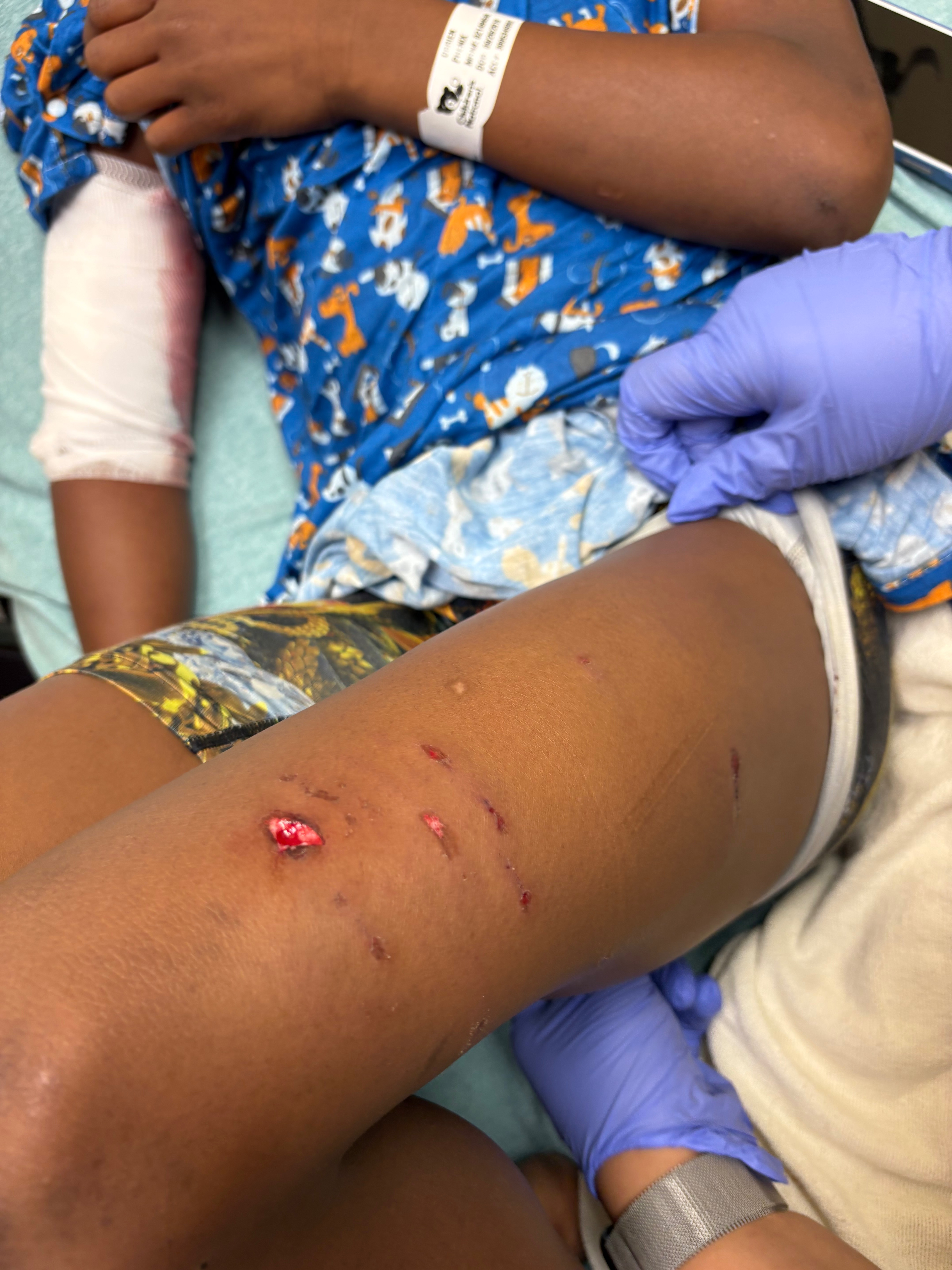 Help Our Family Recover From Viscous Dog campaign photo, 5 of 6