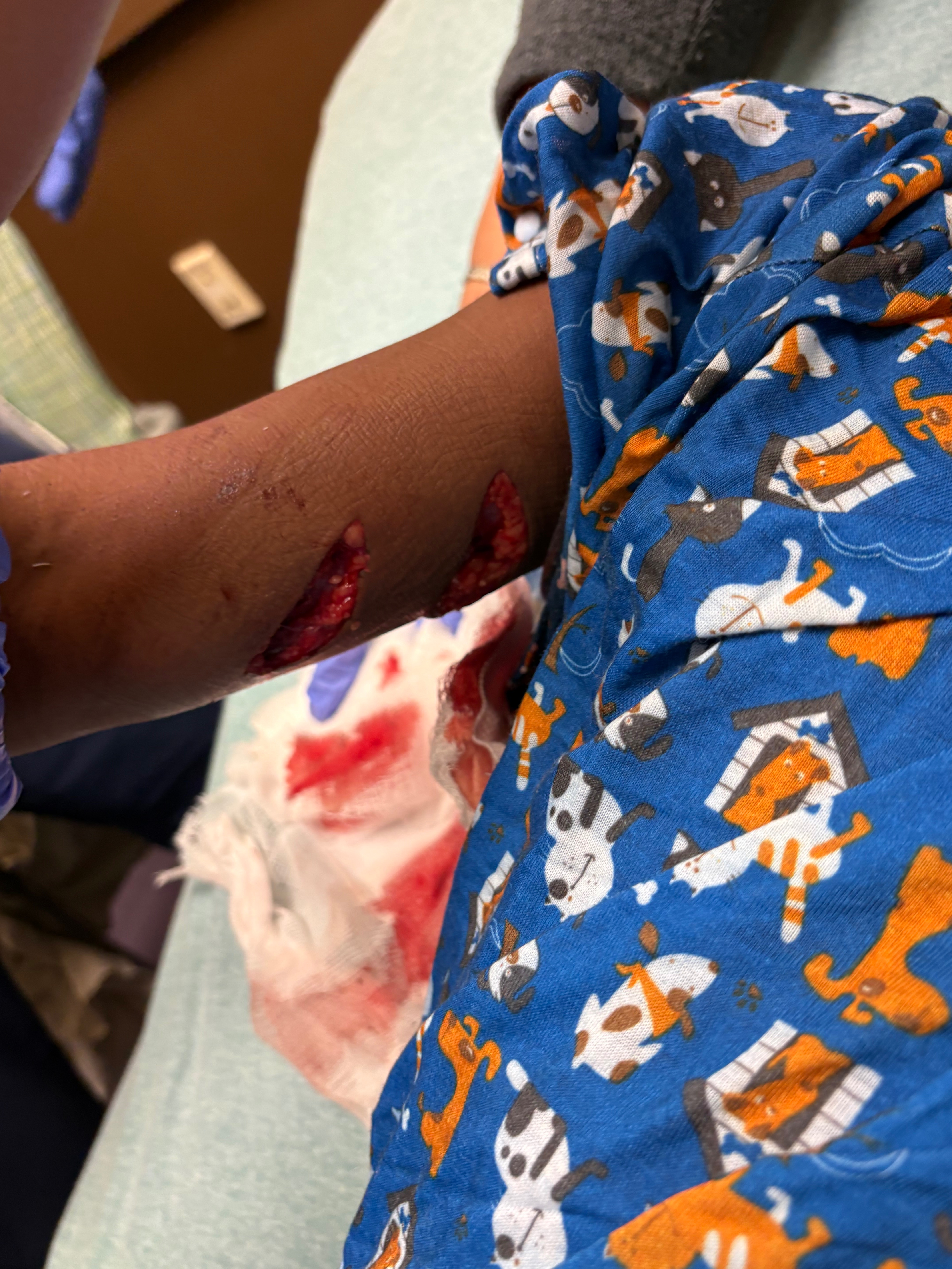 Help Our Family Recover From Viscous Dog campaign photo, 2 of 6