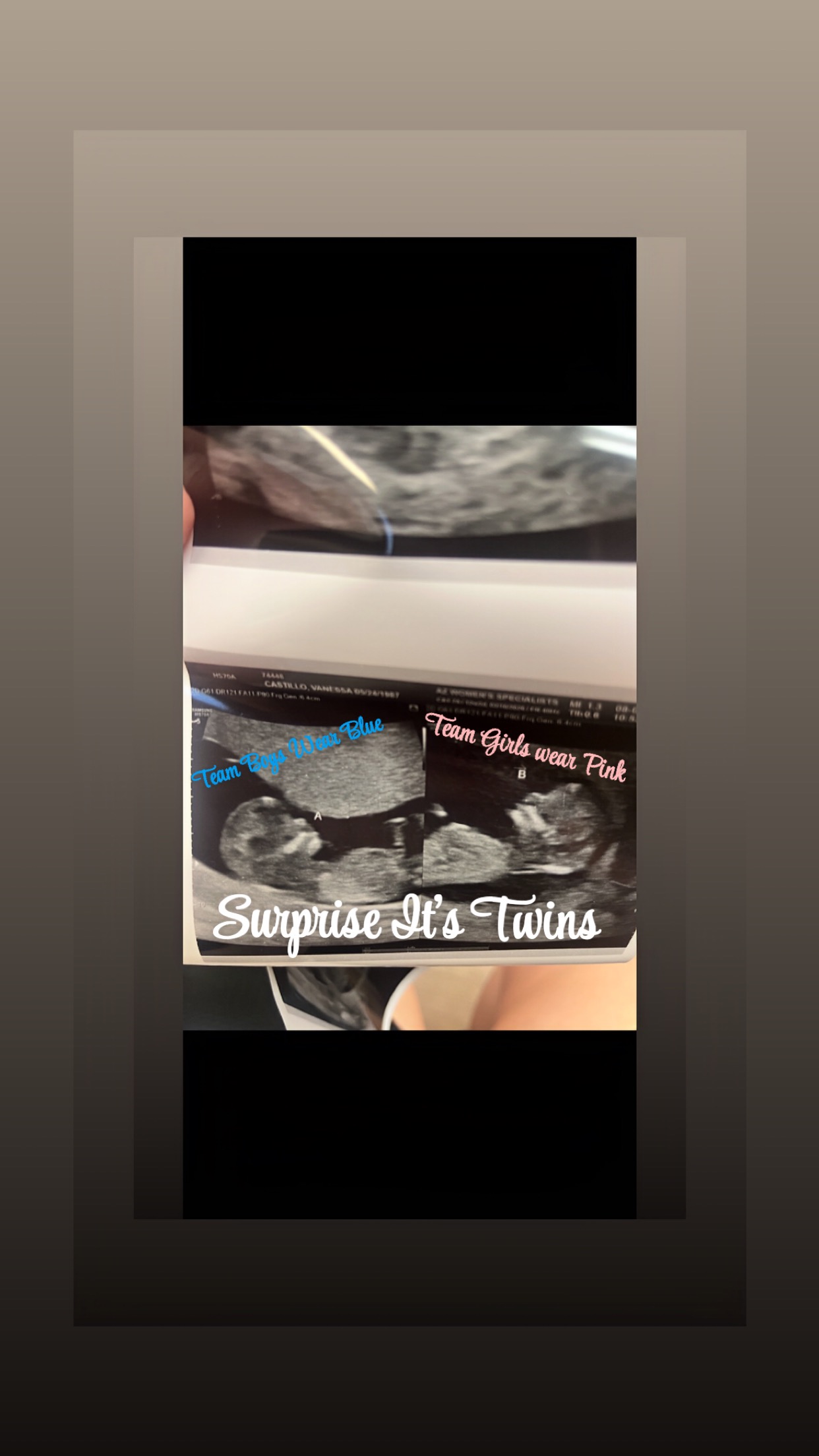 Help cover surgery to save my baby boys life’s campaign photo, 2 of 4