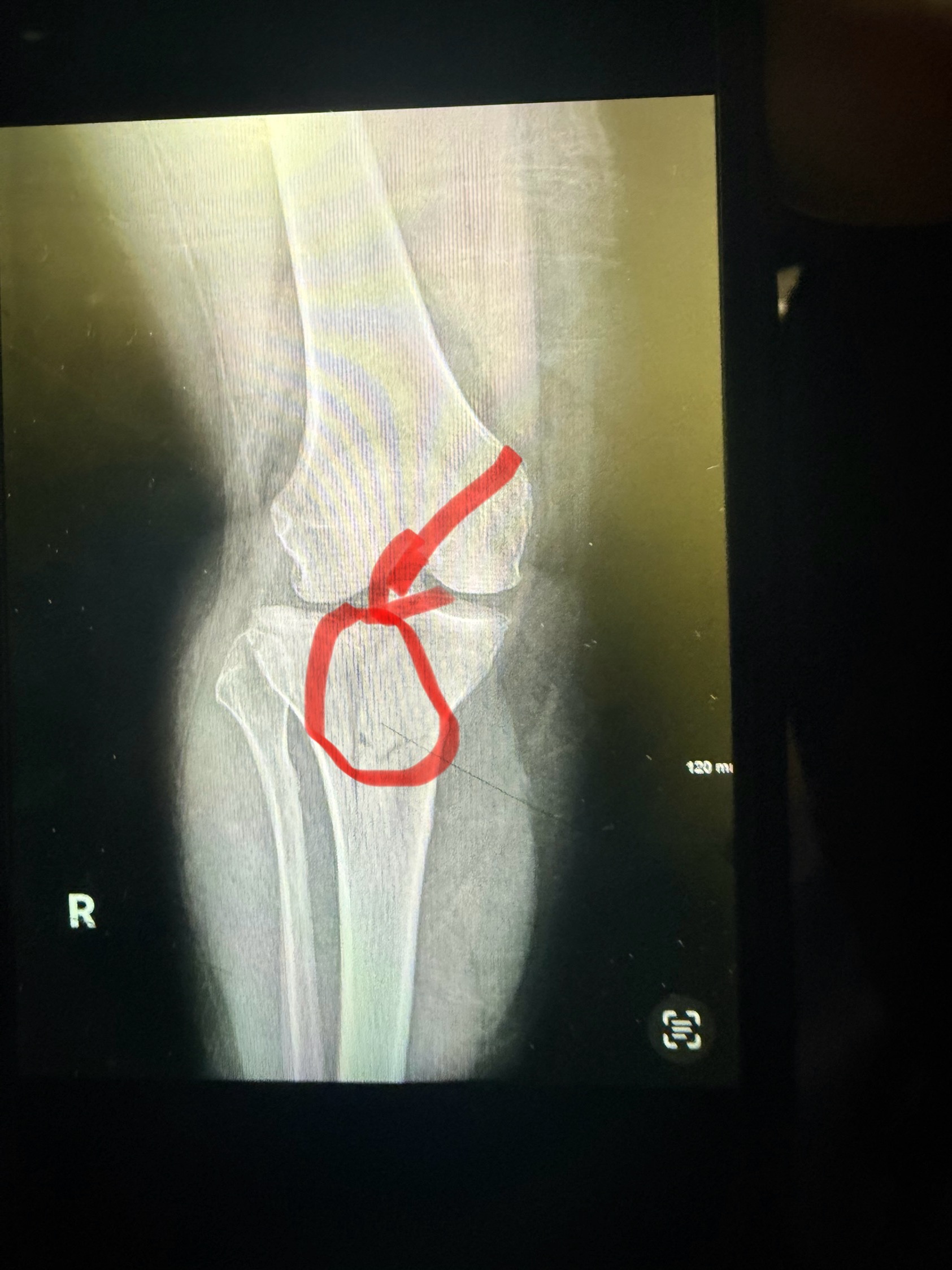 Donate to Maureen's Journey to Recovery campaign photo, 4 of 5