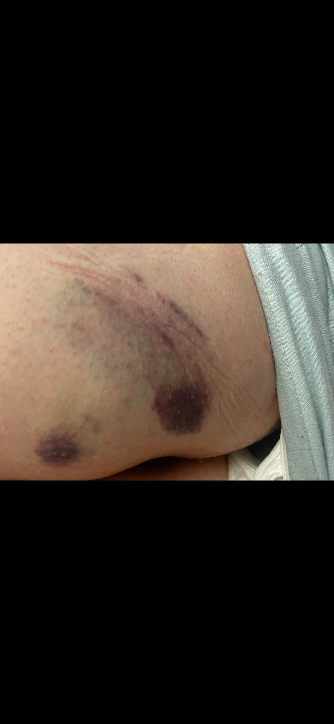 Support mother who broke her back horseback riding campaign photo, 2 of 8