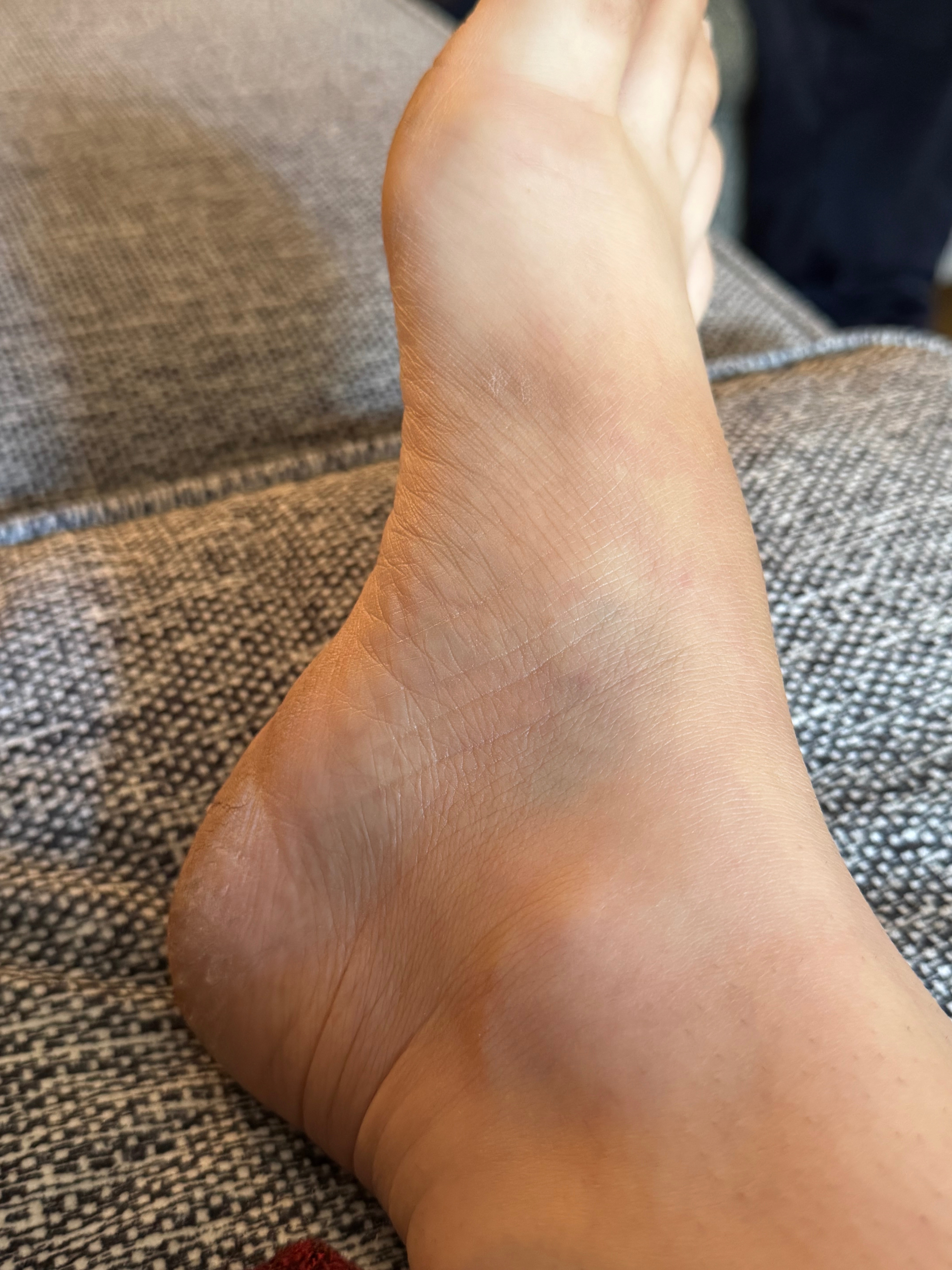 Aidons Mélanie à se relever après sa grave blessure au genou campaign photo, 5 of 7