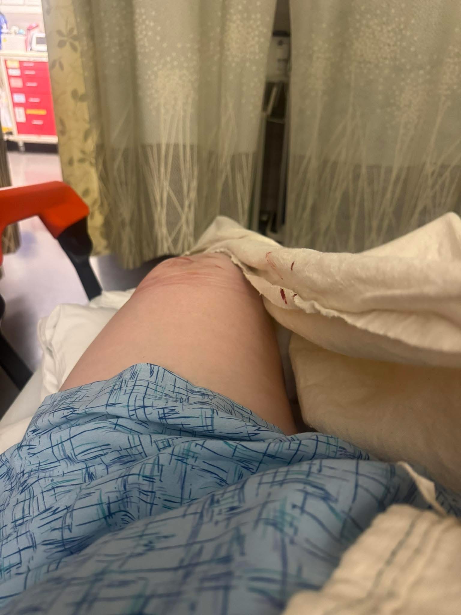 Support Rachel’s Recovery After Surgery campaign photo, 4 of 8