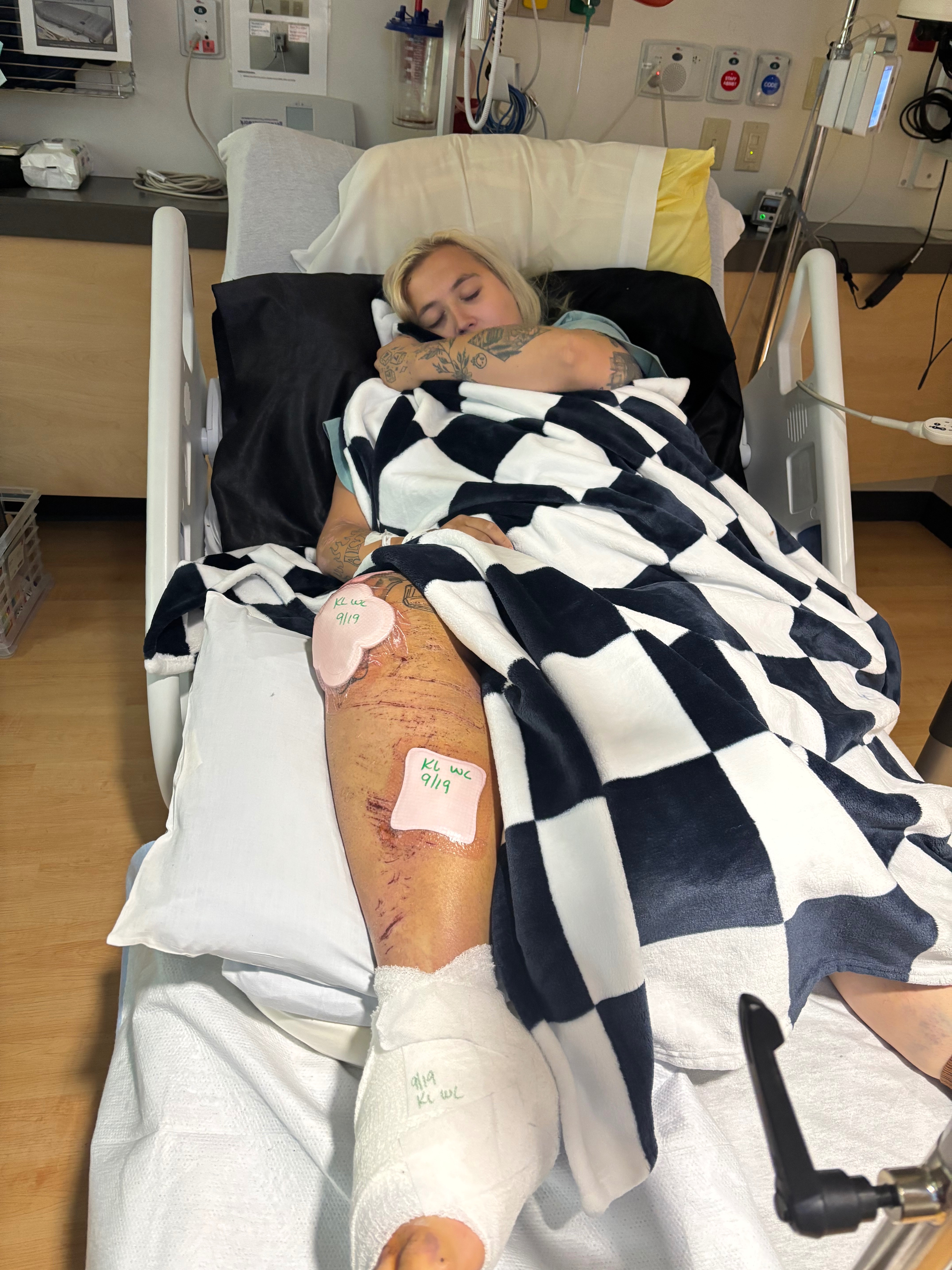 Support Izy's Long Road to Recovery campaign photo, 5 of 8