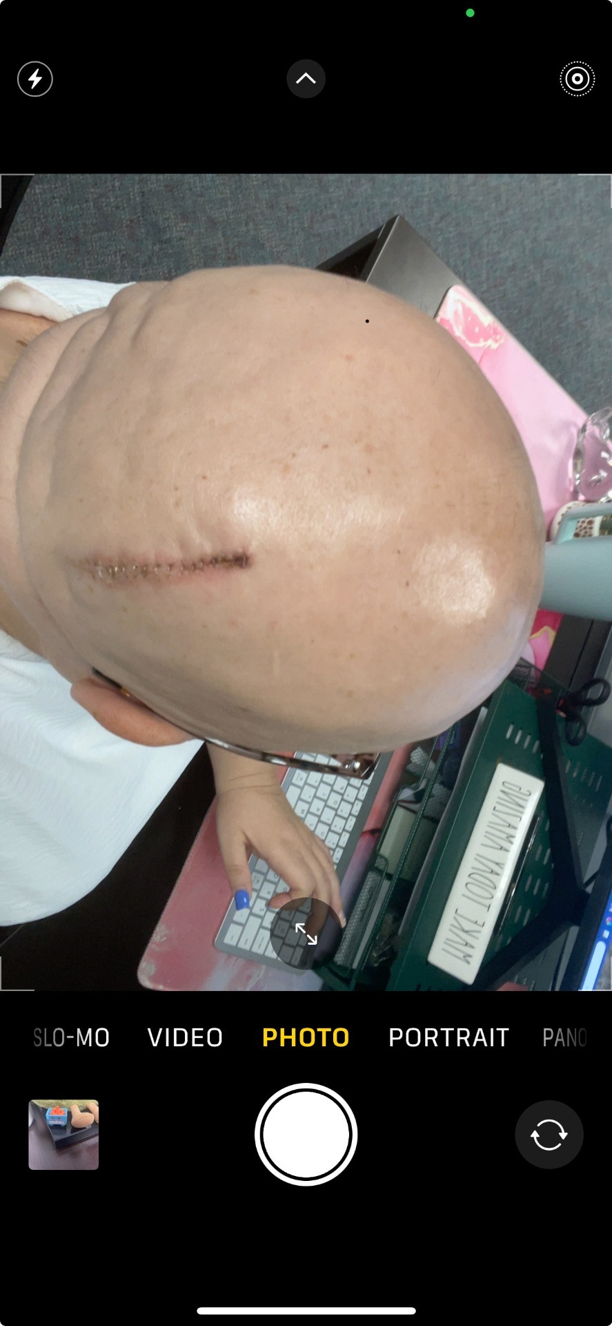 Donate to Sarah's Fight for Health and Hope campaign photo, 4 of 8