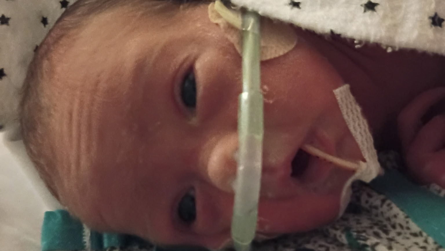 Help Family support baby in NICU photo