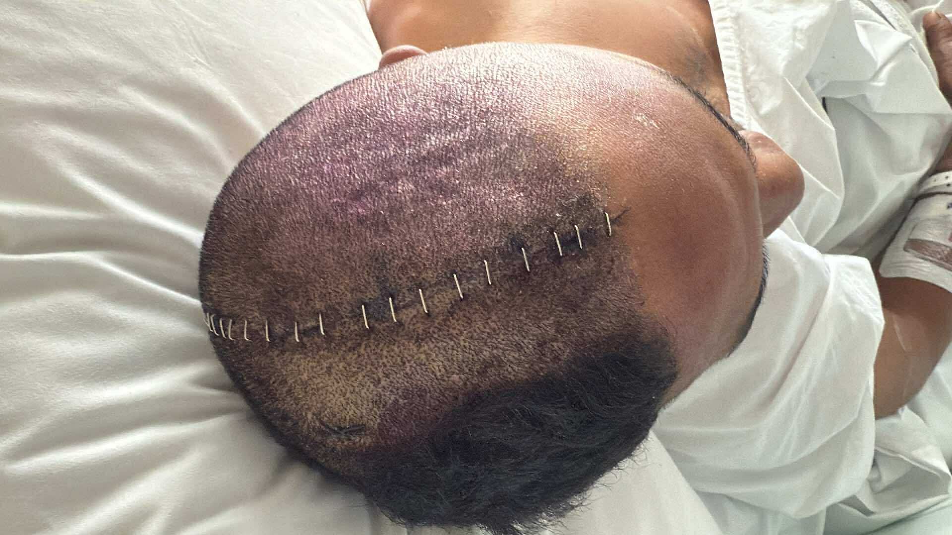 Francis long road to recovery campaign photo, 4 of 6