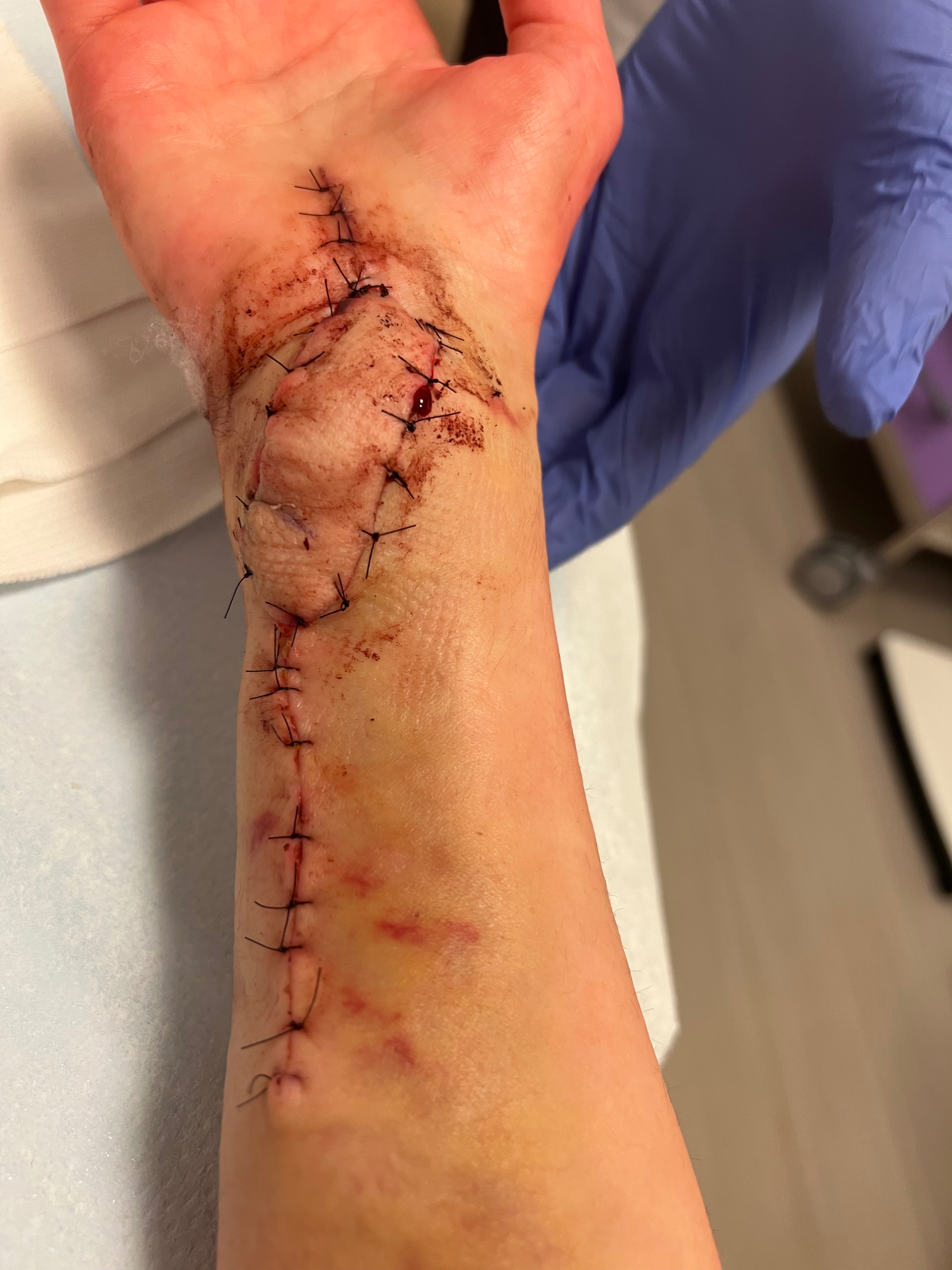A Missile Took My Hand… But Not My Hope" campaign photo, 5 of 6