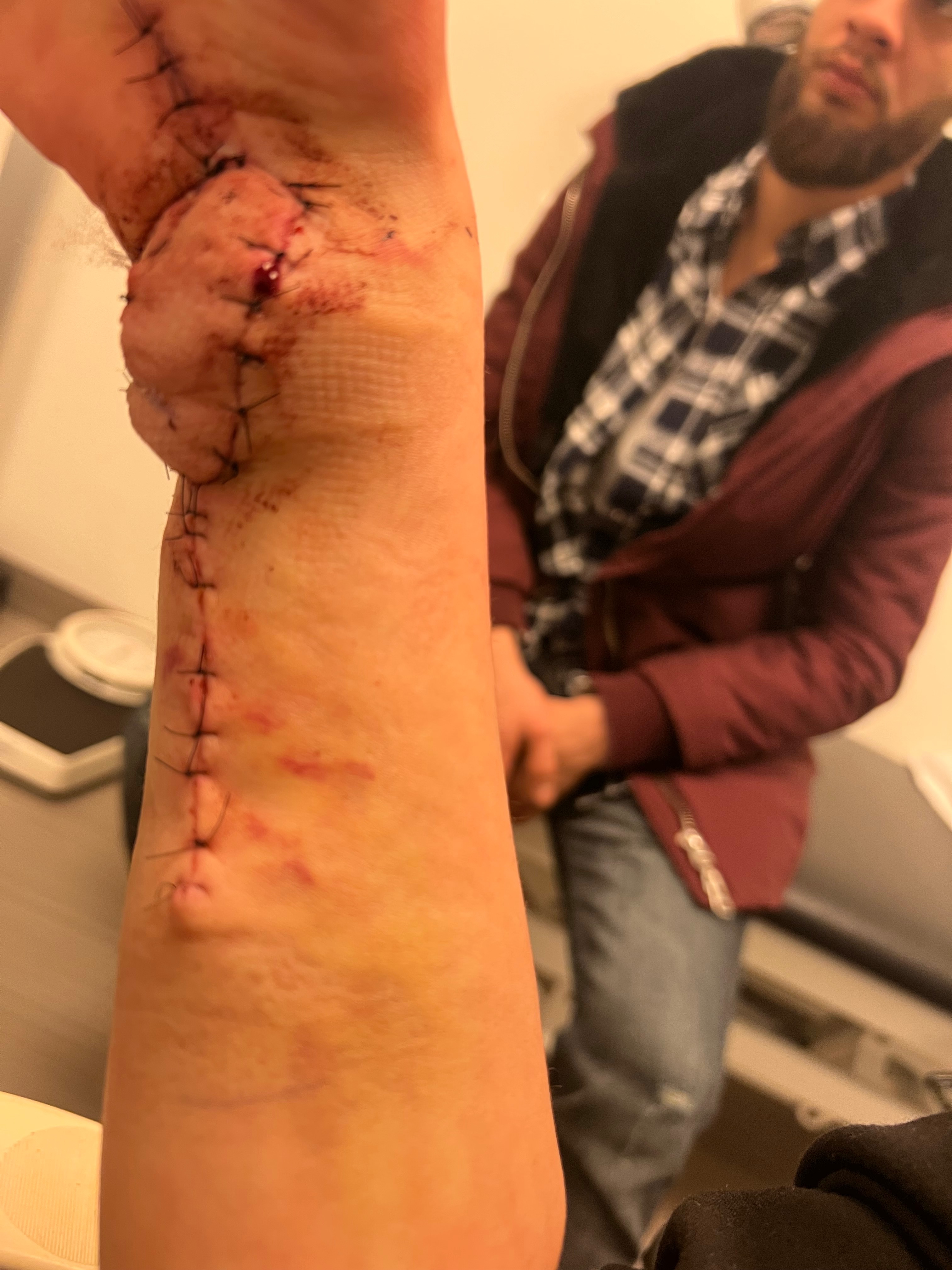 A Missile Took My Hand… But Not My Hope" campaign photo, 2 of 6