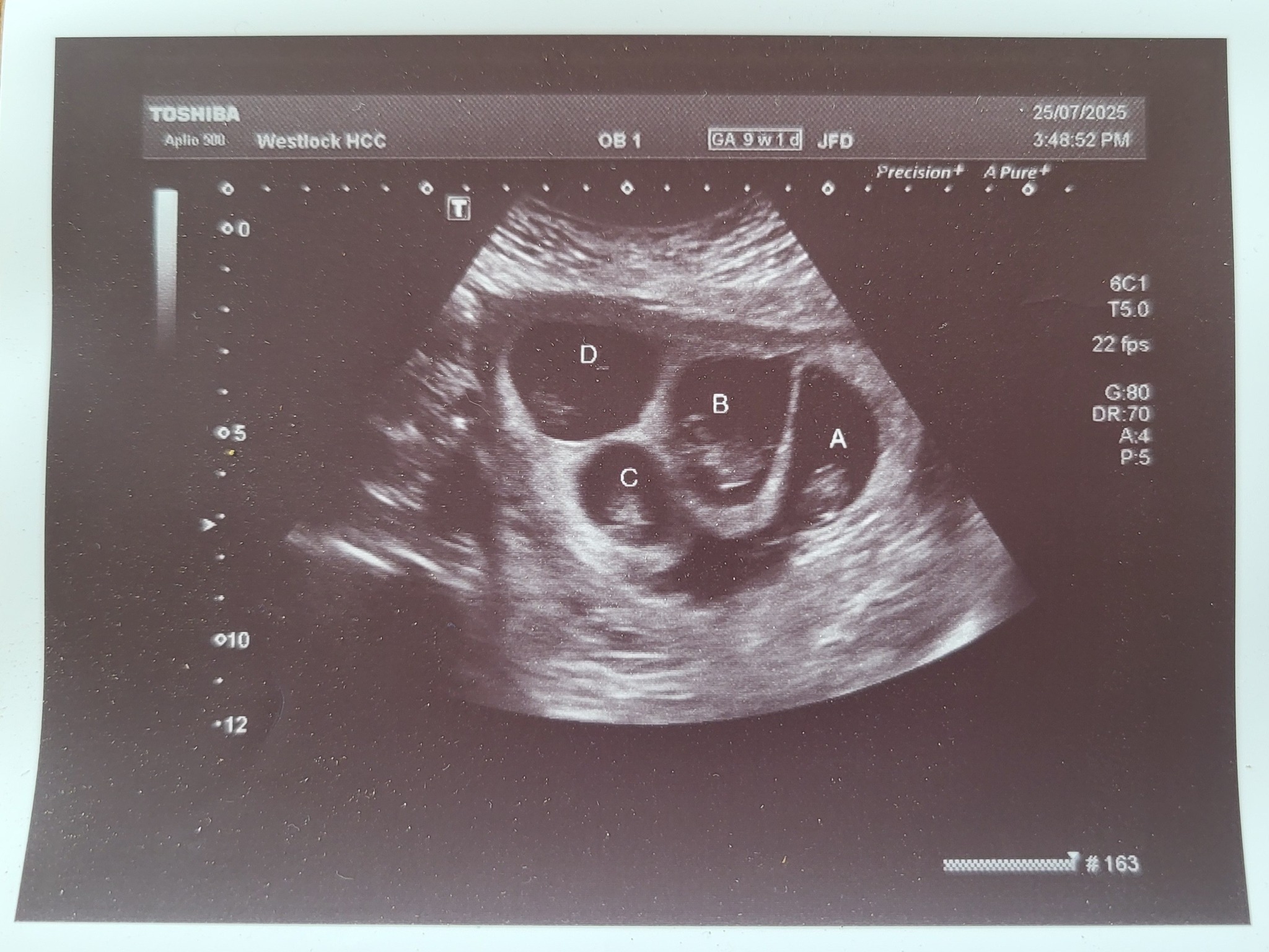 Westlock County Quadruplets campaign photo, 4 of 5