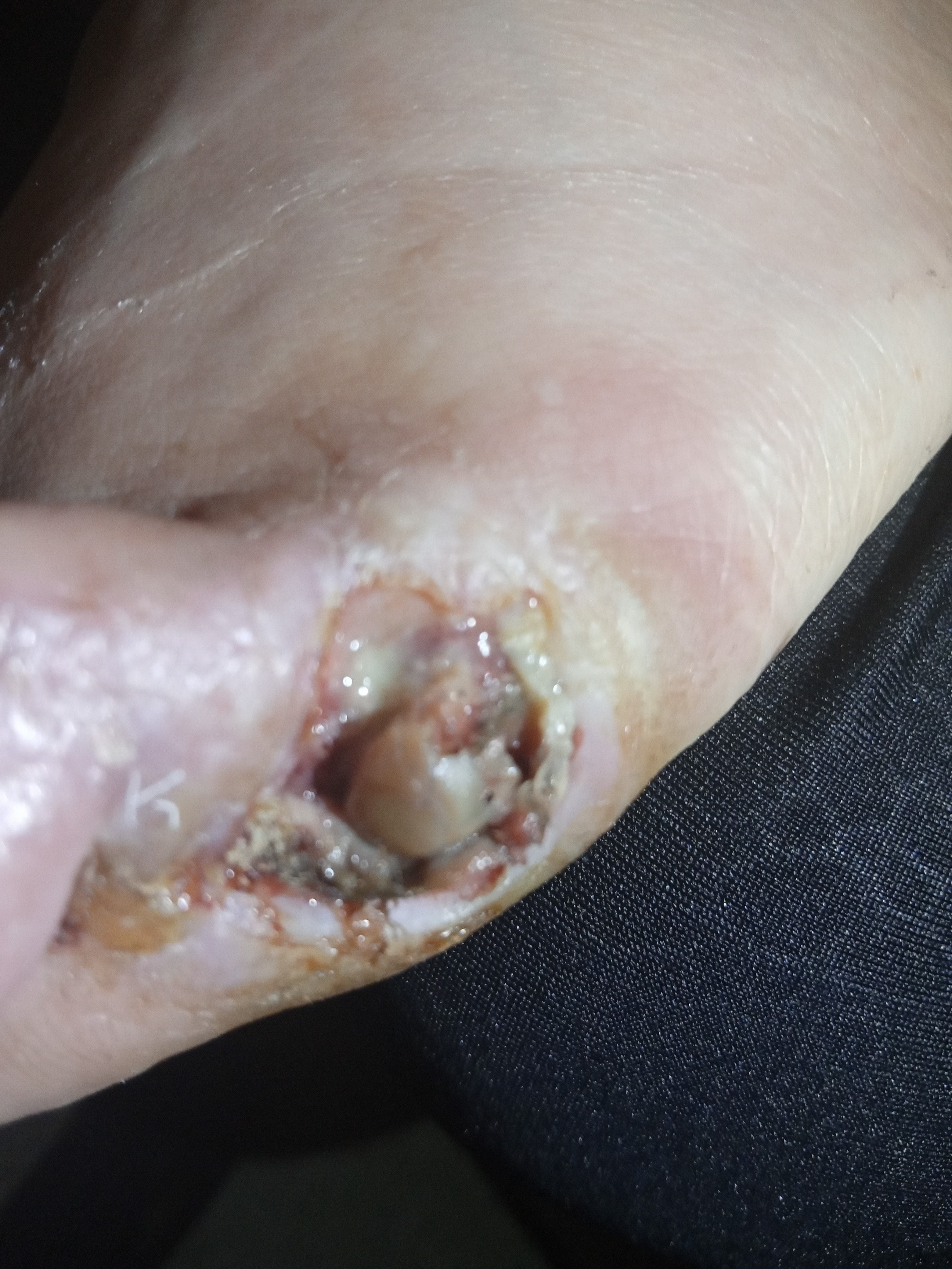 Brenda's medical campaign photo, 5 of 6