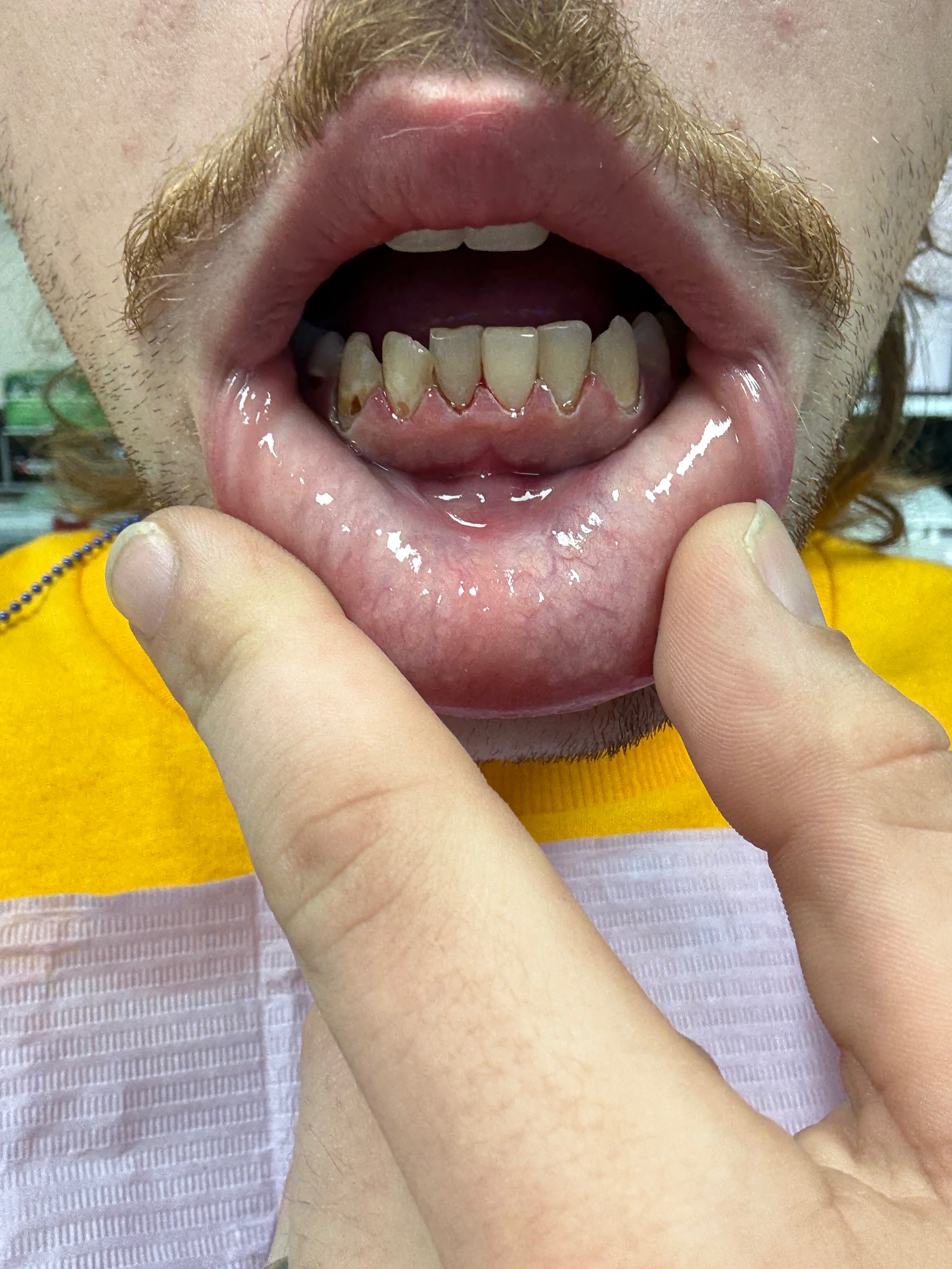 Support The Smile Project: Transform Lives campaign photo, 2 of 8