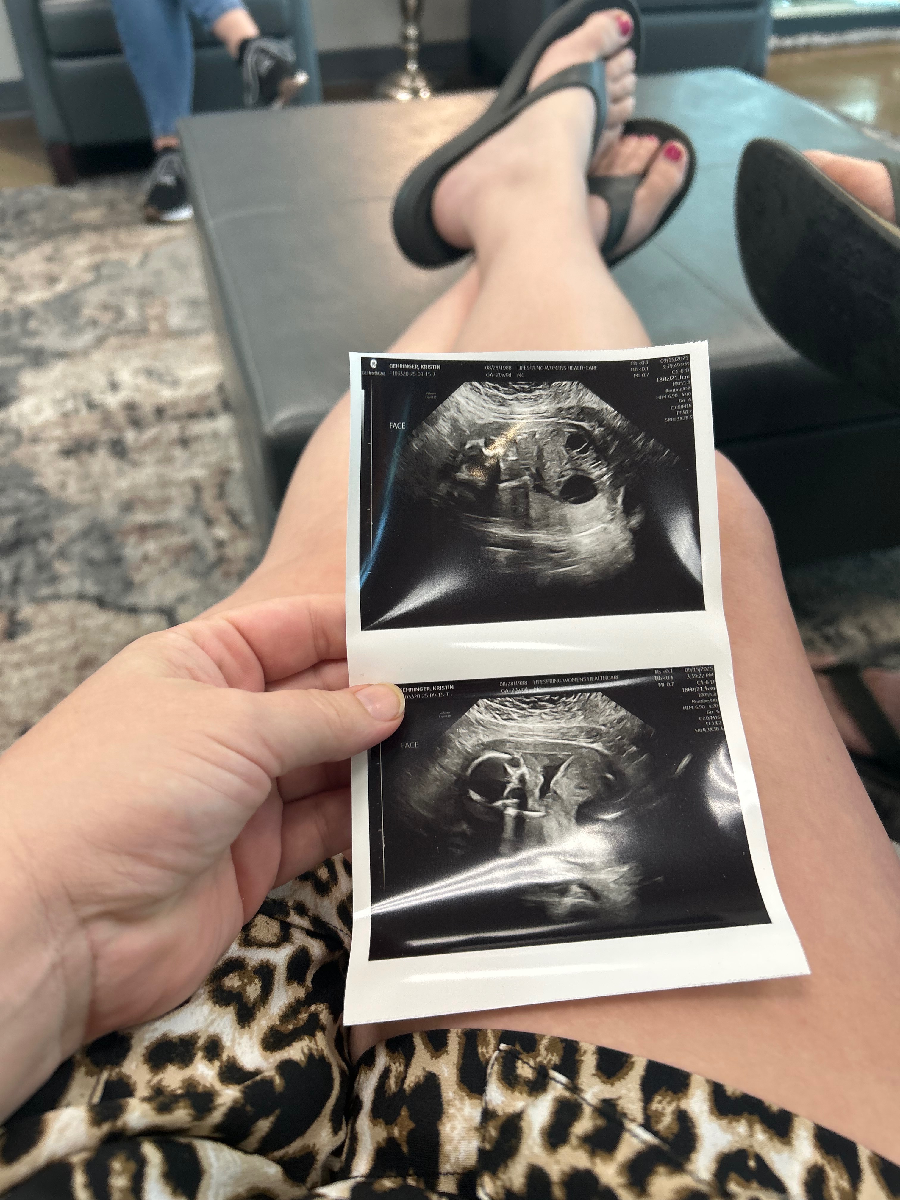 Donate to Ease Baby Tucker's Family's Burden campaign photo, 5 of 8