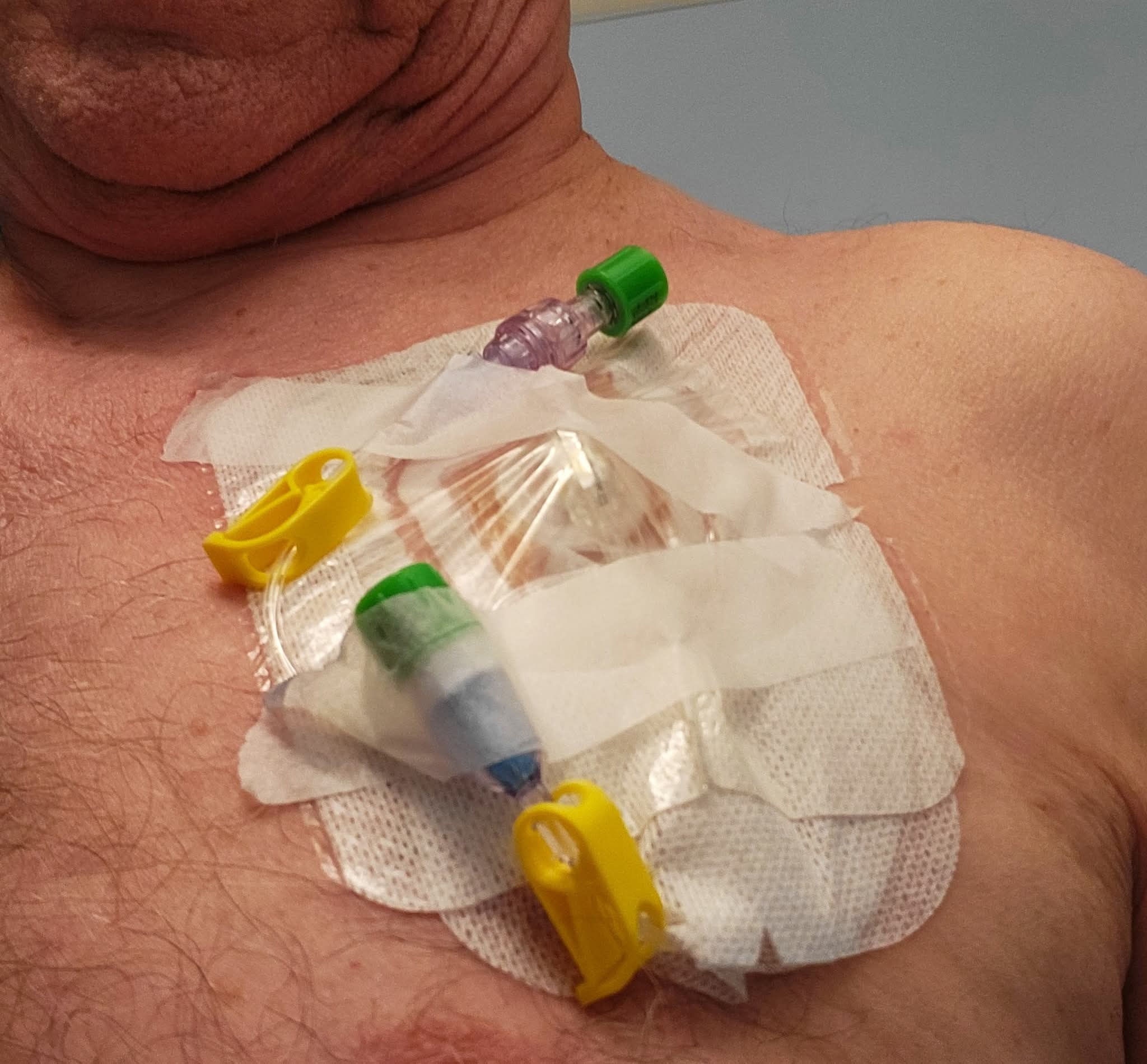 URGENT! Help me get home to see my dad before he dies campaign photo, 2 of 5