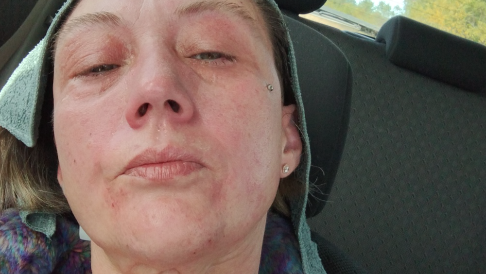 Bill due to medical conditions photo