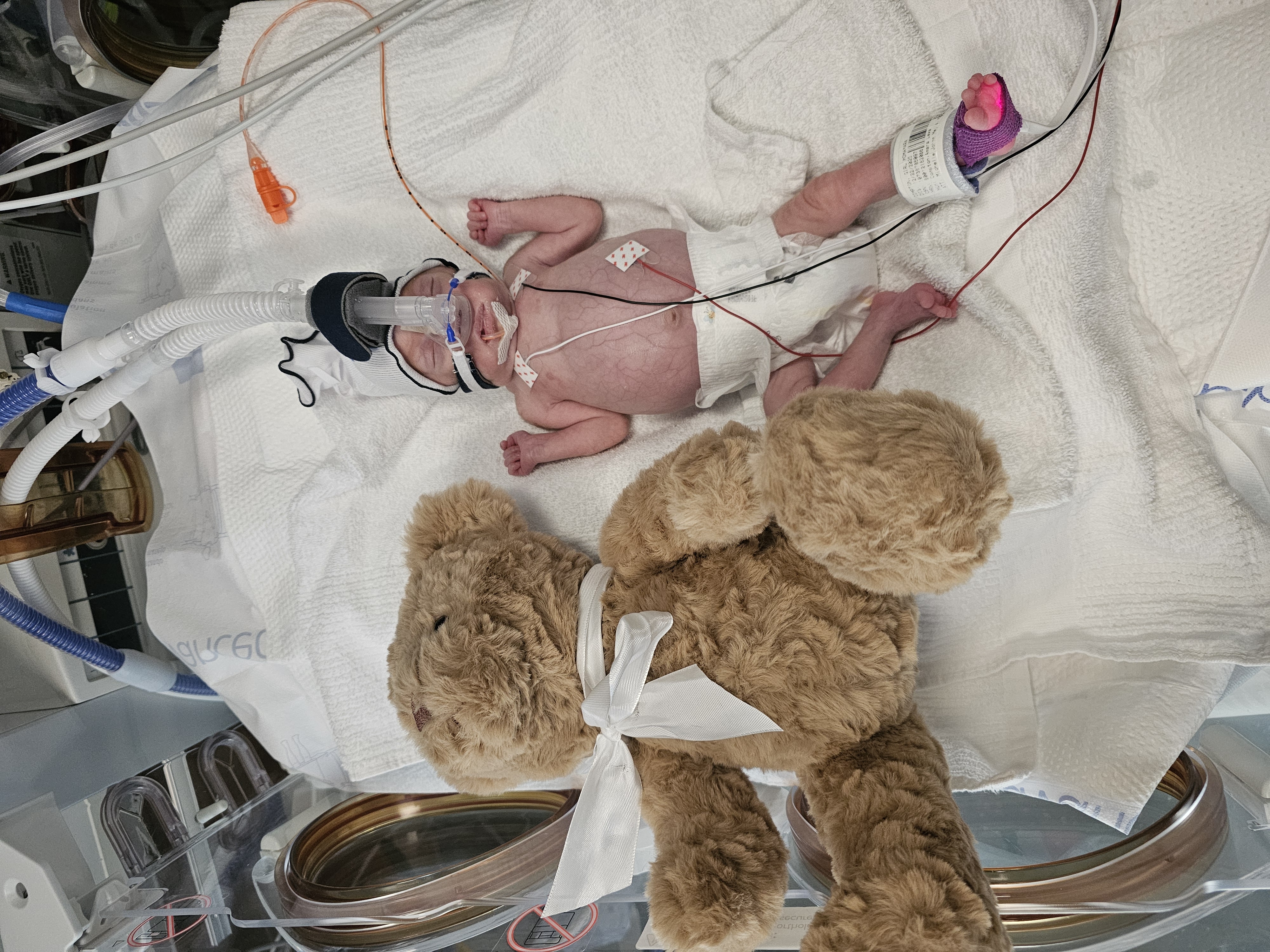 Baby Lulas NiCU fund campaign photo, 2 of 7