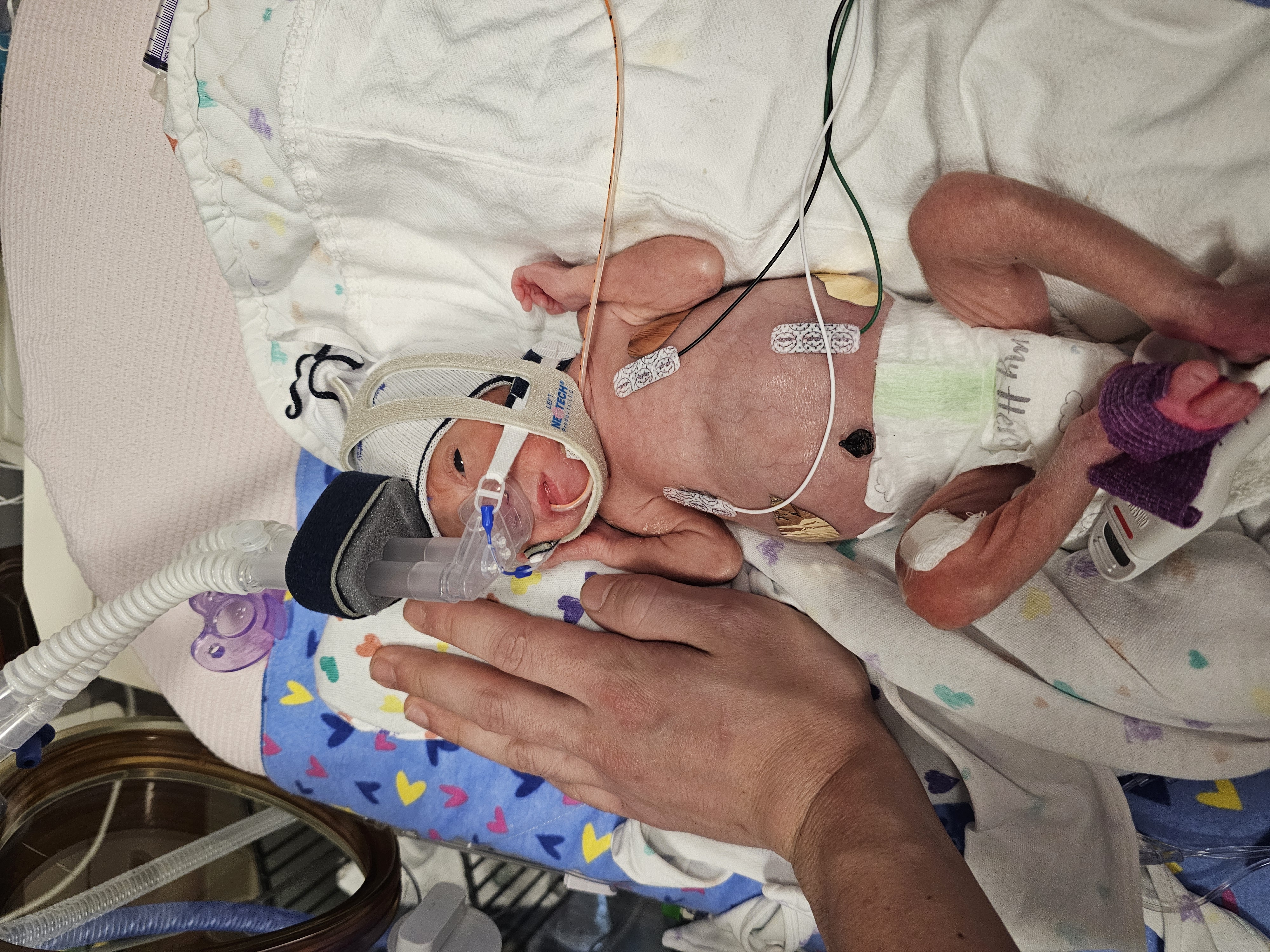 Baby Lulas NiCU fund campaign photo, 5 of 7