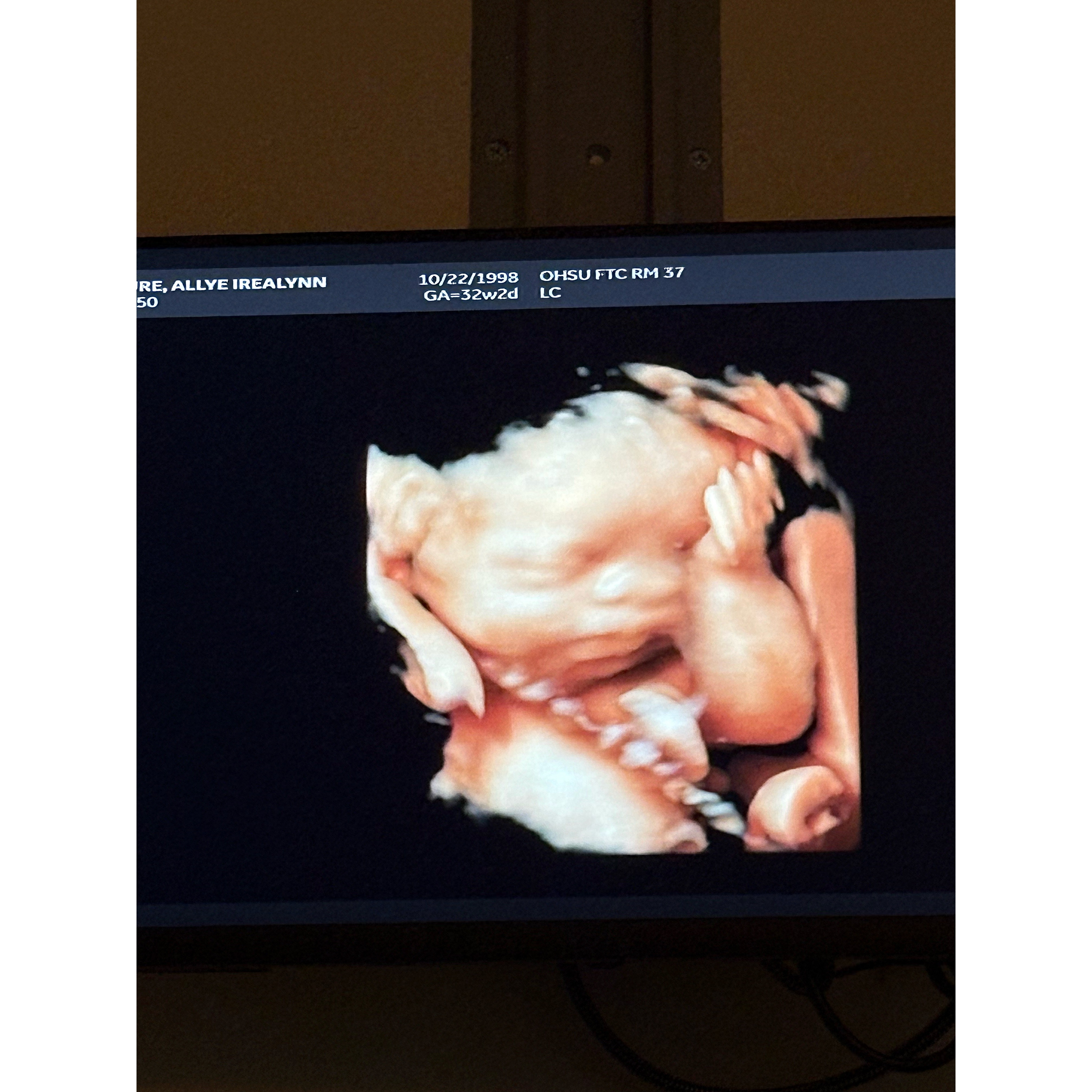 Sophia’s CDH Journey campaign photo, 2 of 4