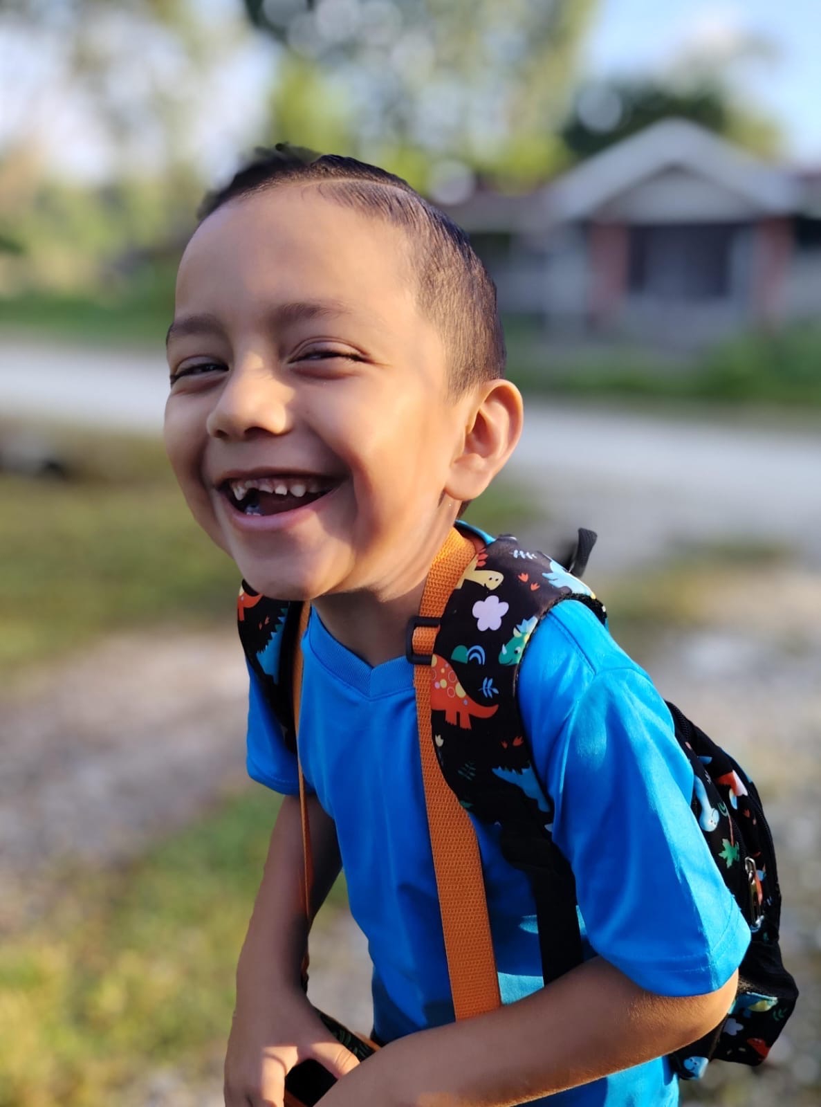 Help Matias See Clearly: Urgent Eye Surgery campaign photo, 4 of 5