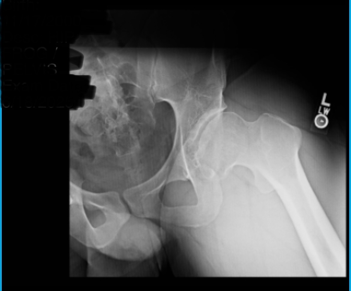 Help a Carpenter With An Arthritic Hip Rebuild His Tools campaign photo, 4 of 7