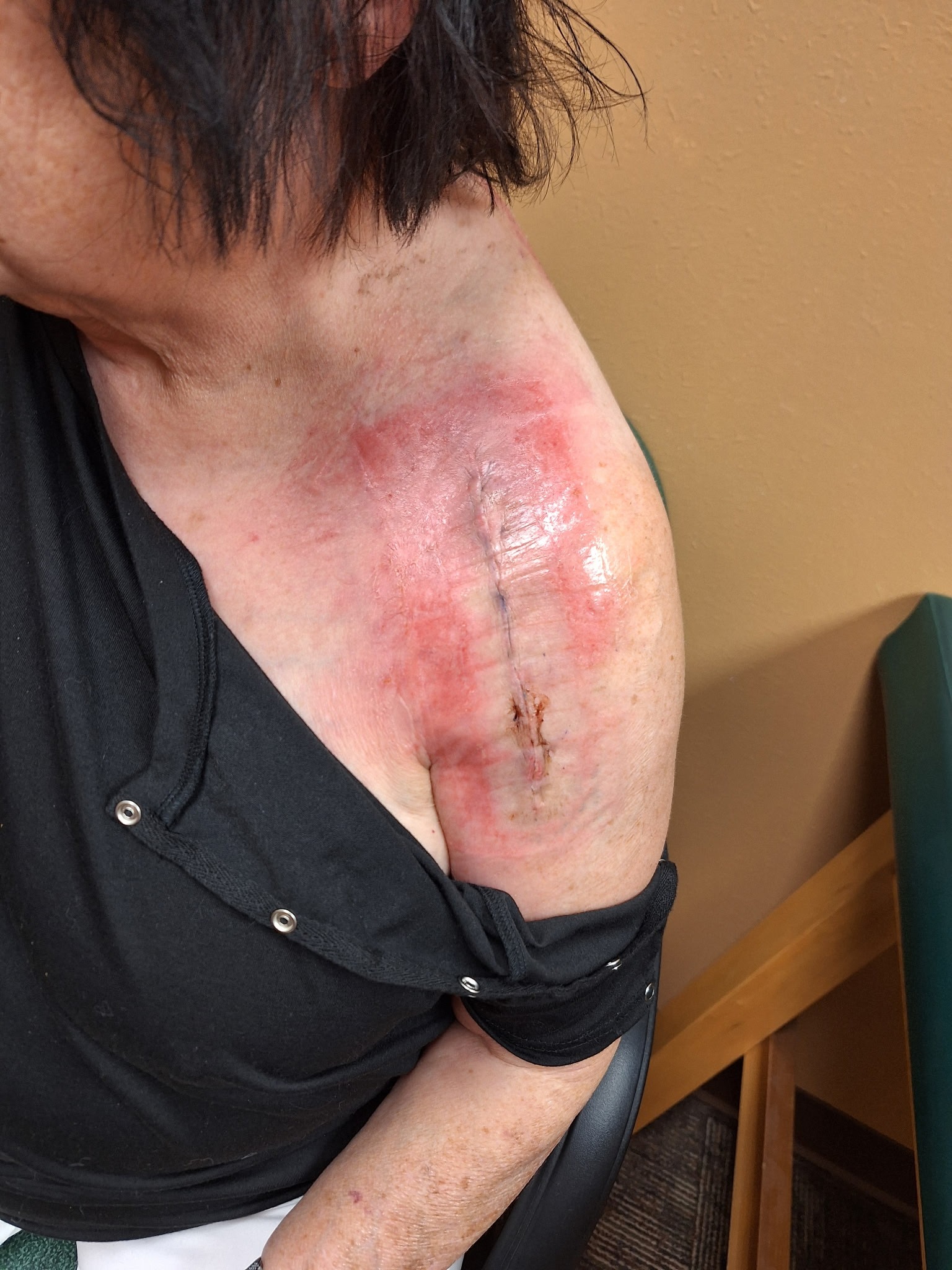 Needing good nice people to help me get back on my feet campaign photo, 2 of 5