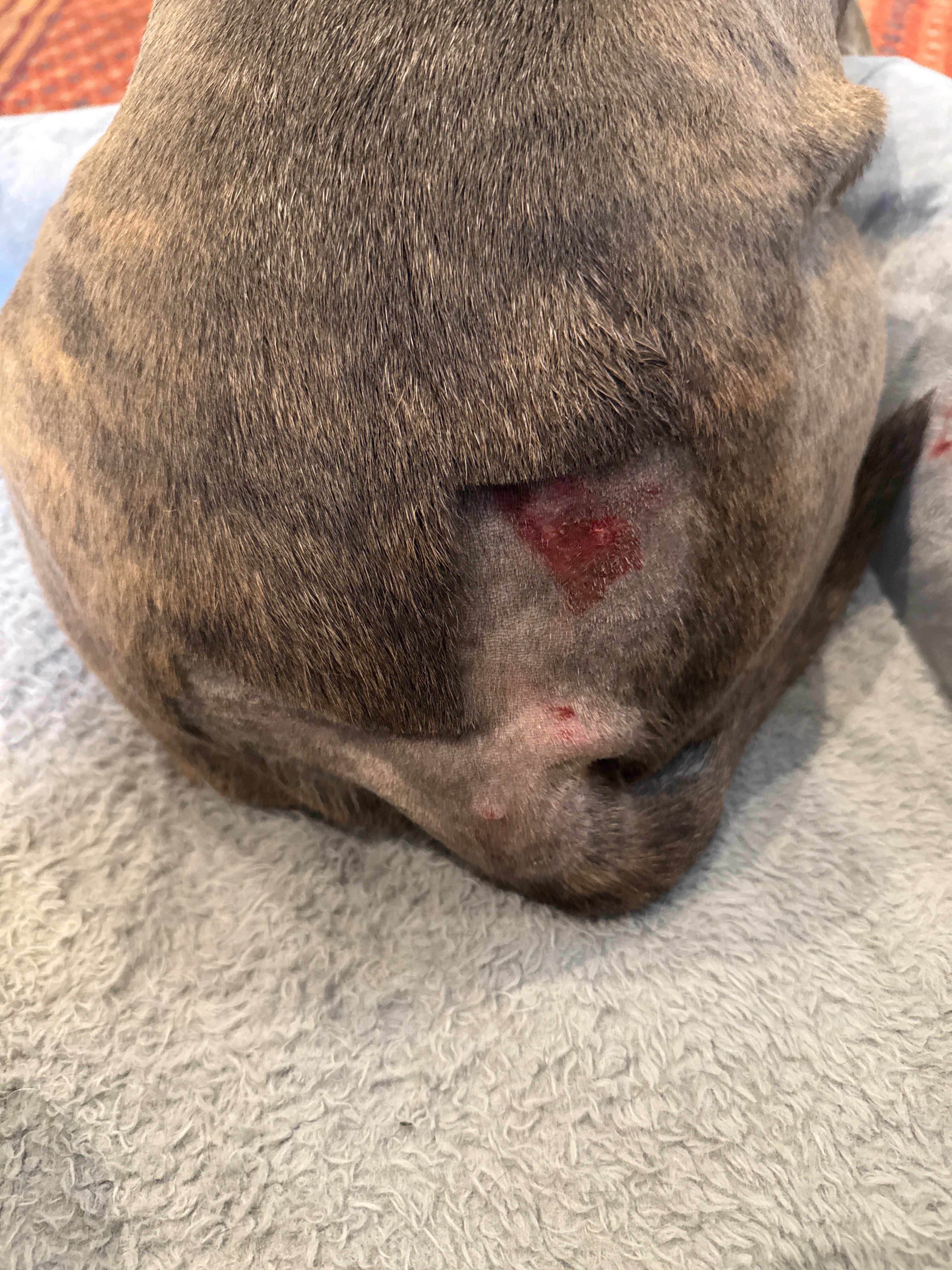 Bia’s Tumor Surgery, Anything Helps campaign photo, 4 of 8