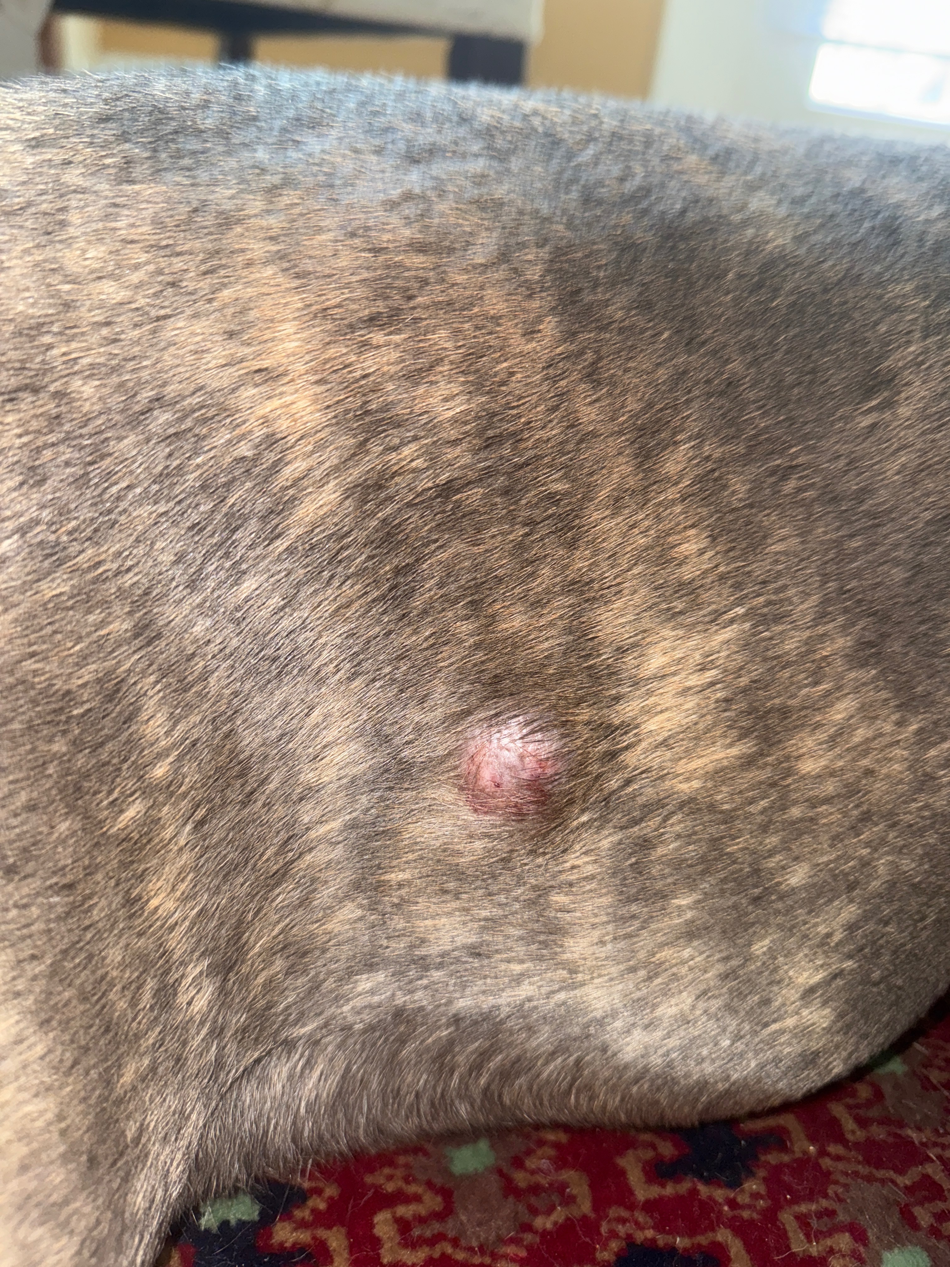 Bia’s Tumor Surgery, Anything Helps campaign photo, 5 of 8