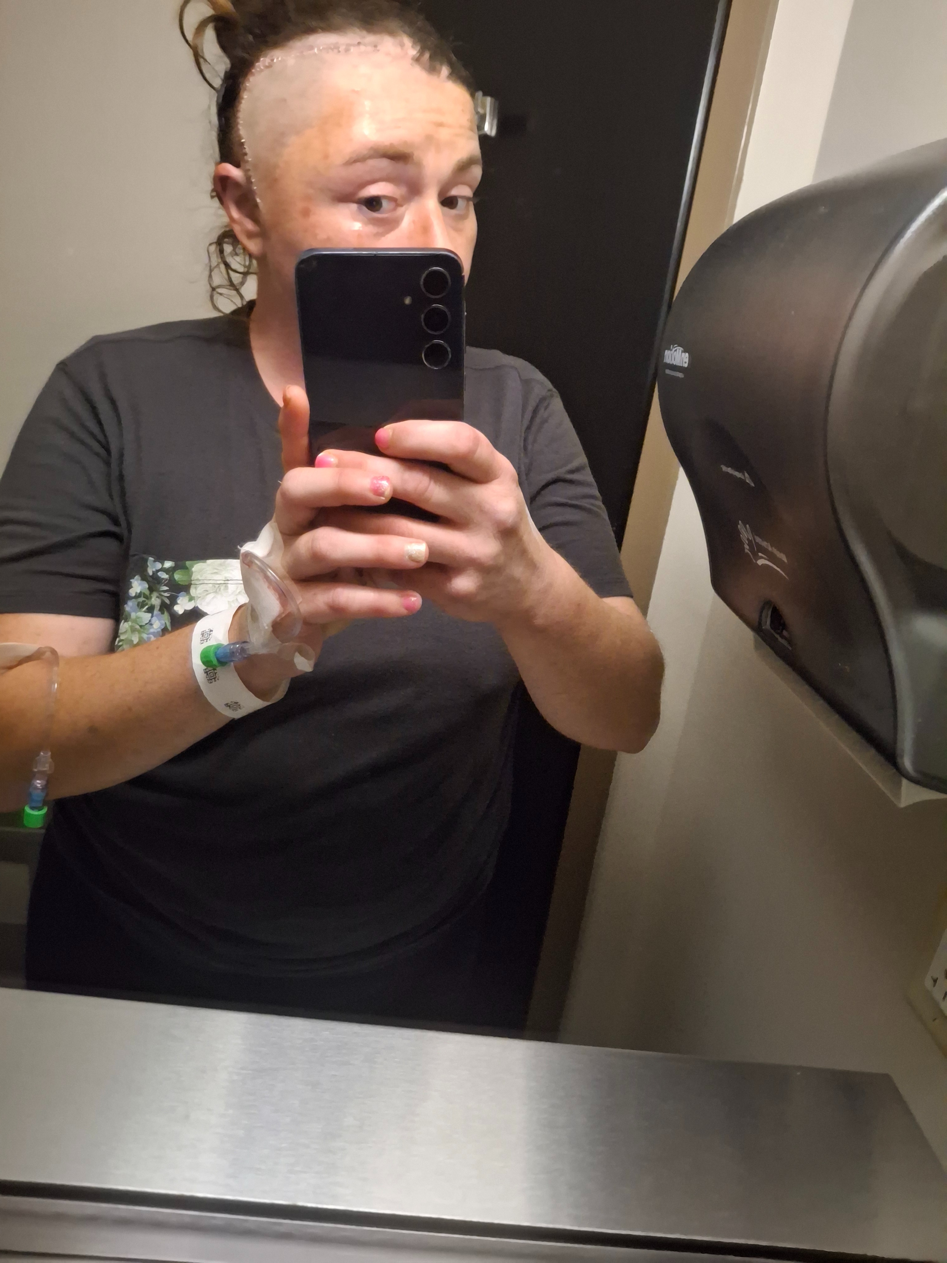 Stage 4 melanoma with a brain mass just removed.. campaign photo, 7 of 8