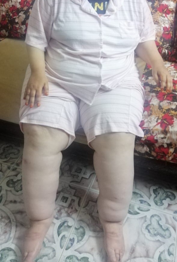 Help Soumaya and Her Mother With Urgent Medical Expenses campaign photo, 4 of 5