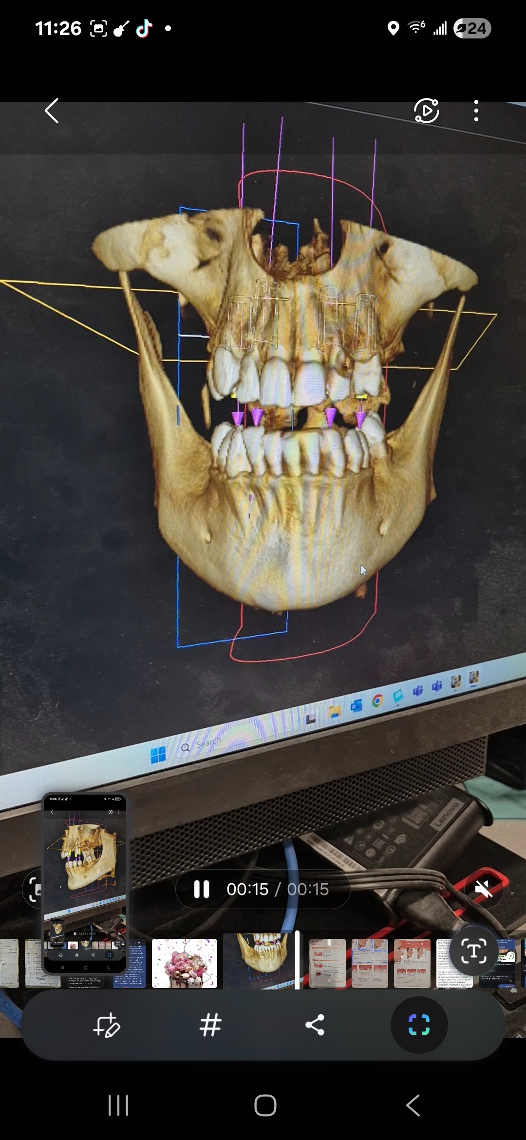 Help Chel-c Smile Again: Urgent Dental Care campaign photo, 4 of 7