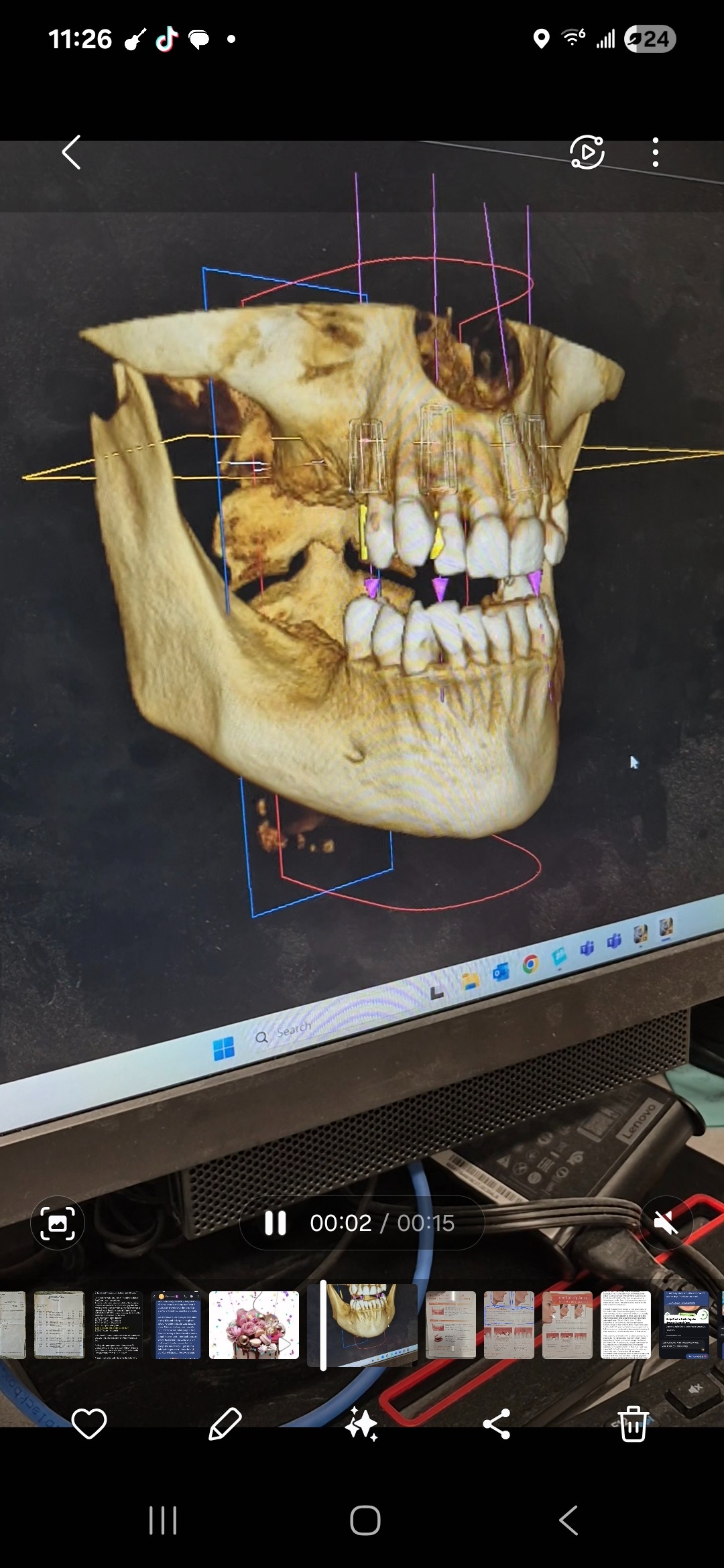 Help Chel-c Smile Again: Urgent Dental Care campaign photo, 6 of 7
