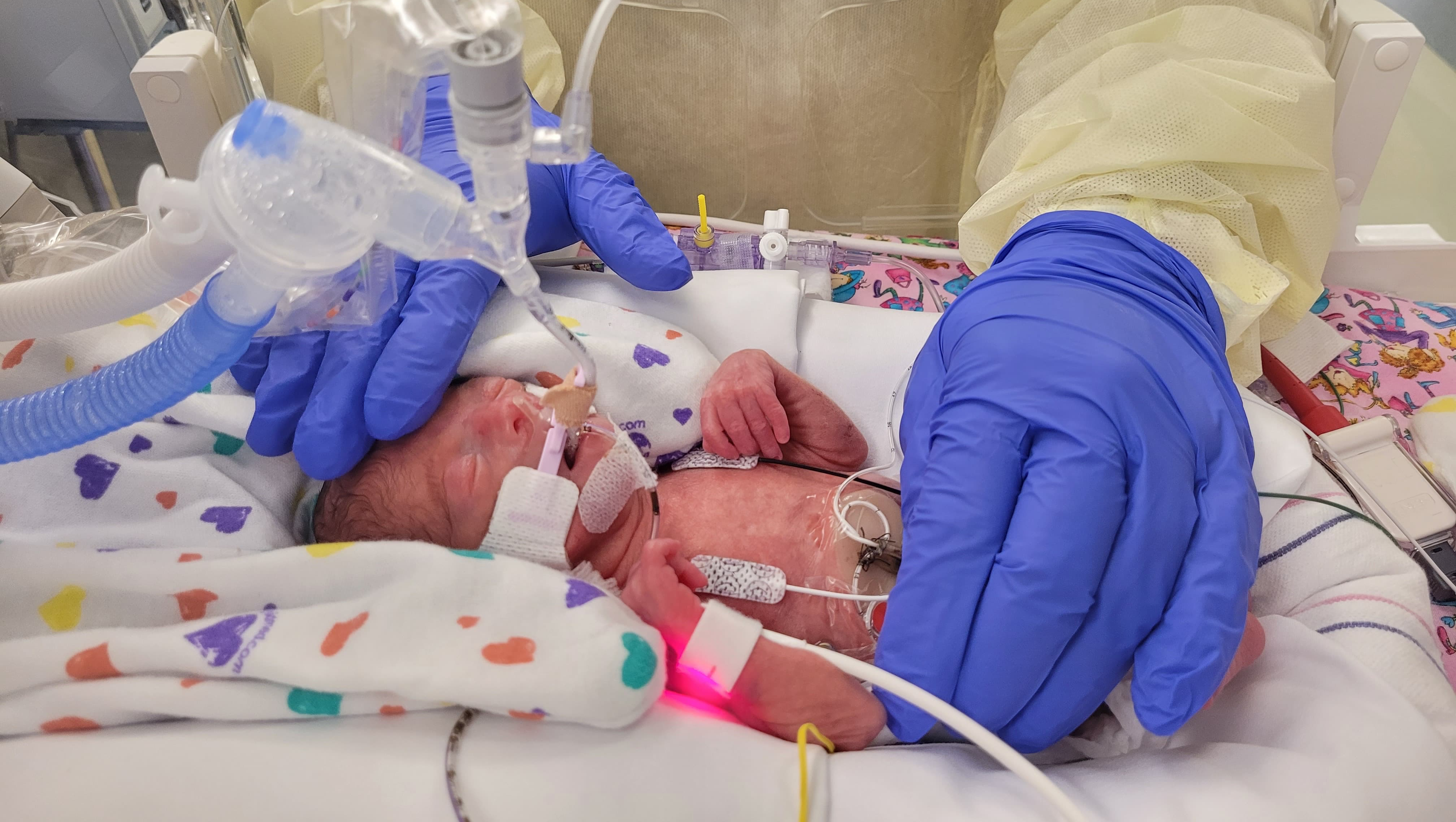 Help Support Sadie-Lynn’s Ongoing Medical Care & Daily Needs photo
