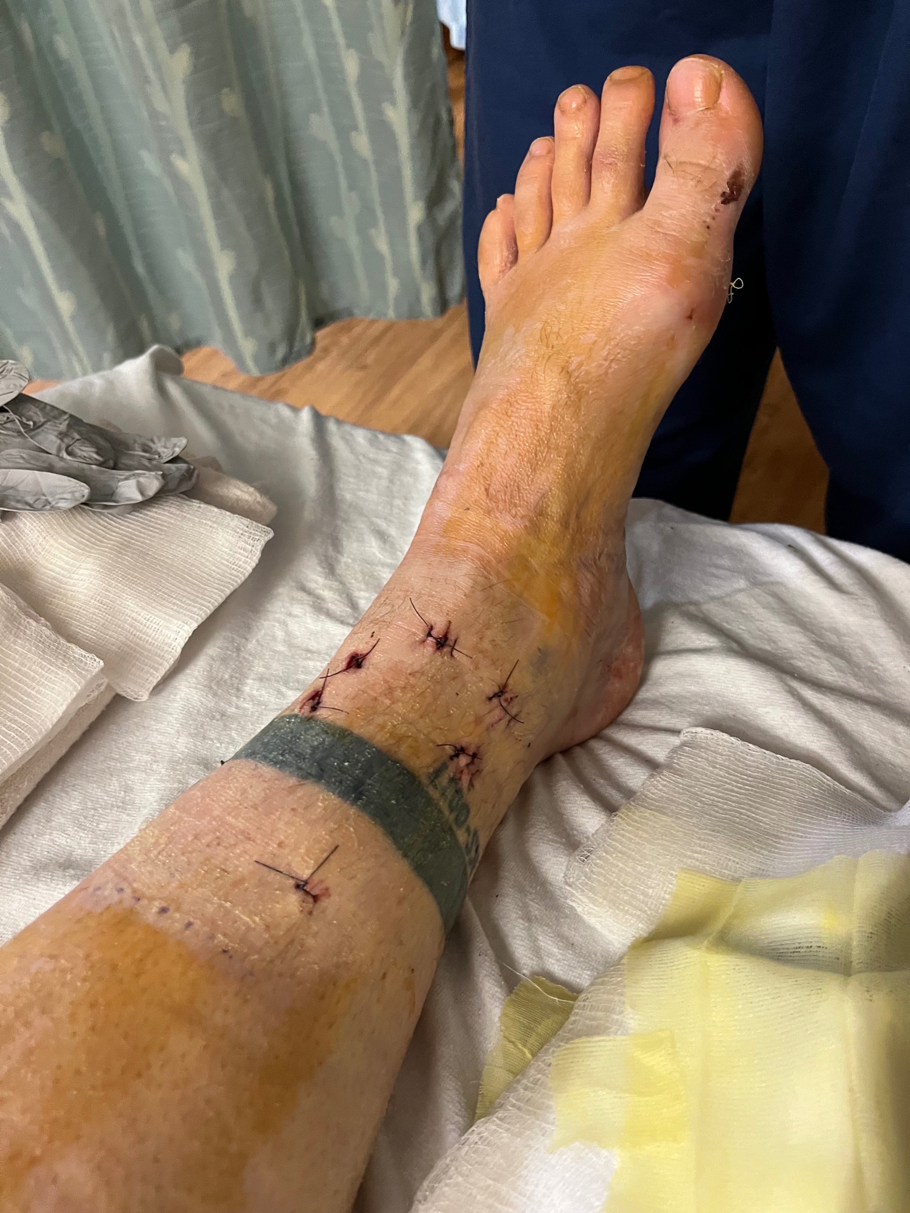 Aid Luke Miller After Motorcycle Accident campaign photo, 5 of 8