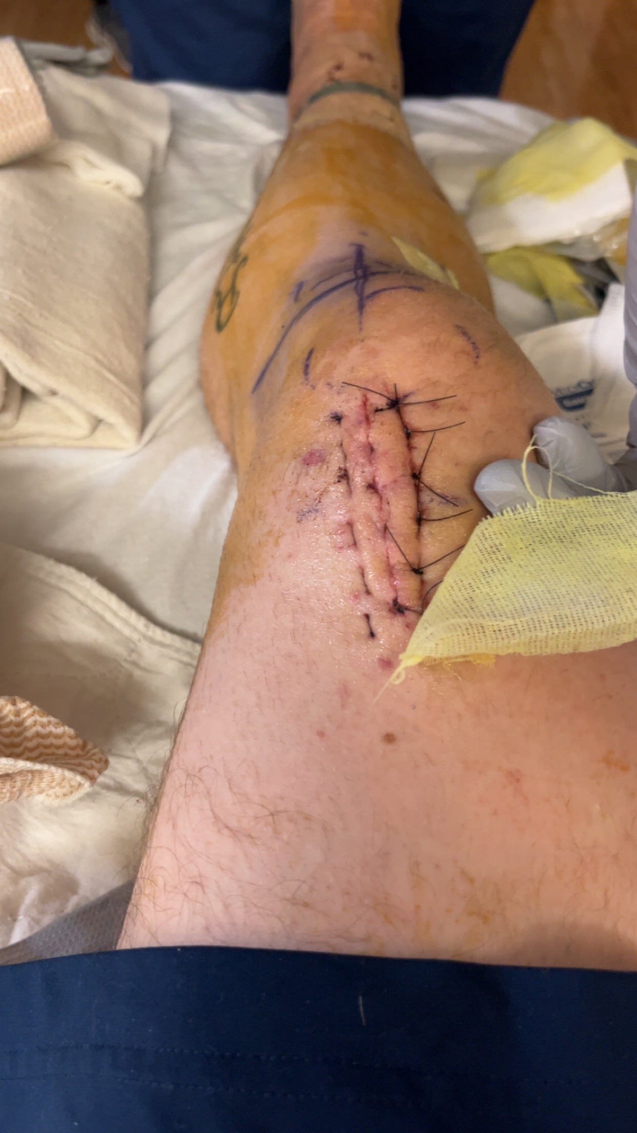 Aid Luke Miller After Motorcycle Accident campaign photo, 6 of 8