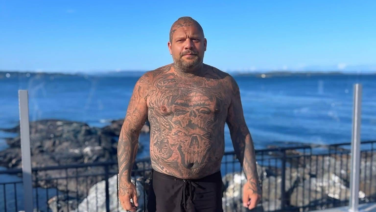 Rays recovery photo