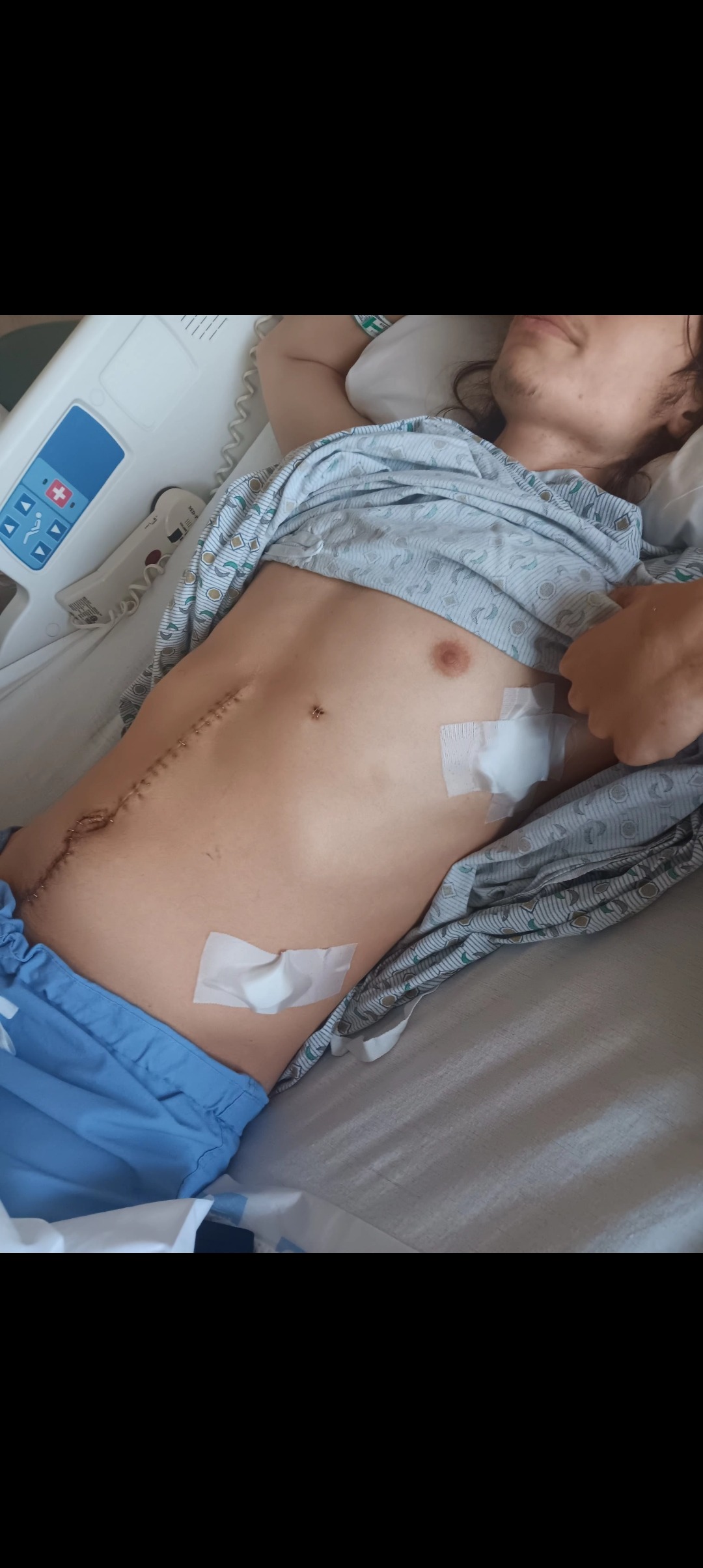 Urgently Help Gaven Overcome Medical and Financial Struggles campaign photo, 4 of 6