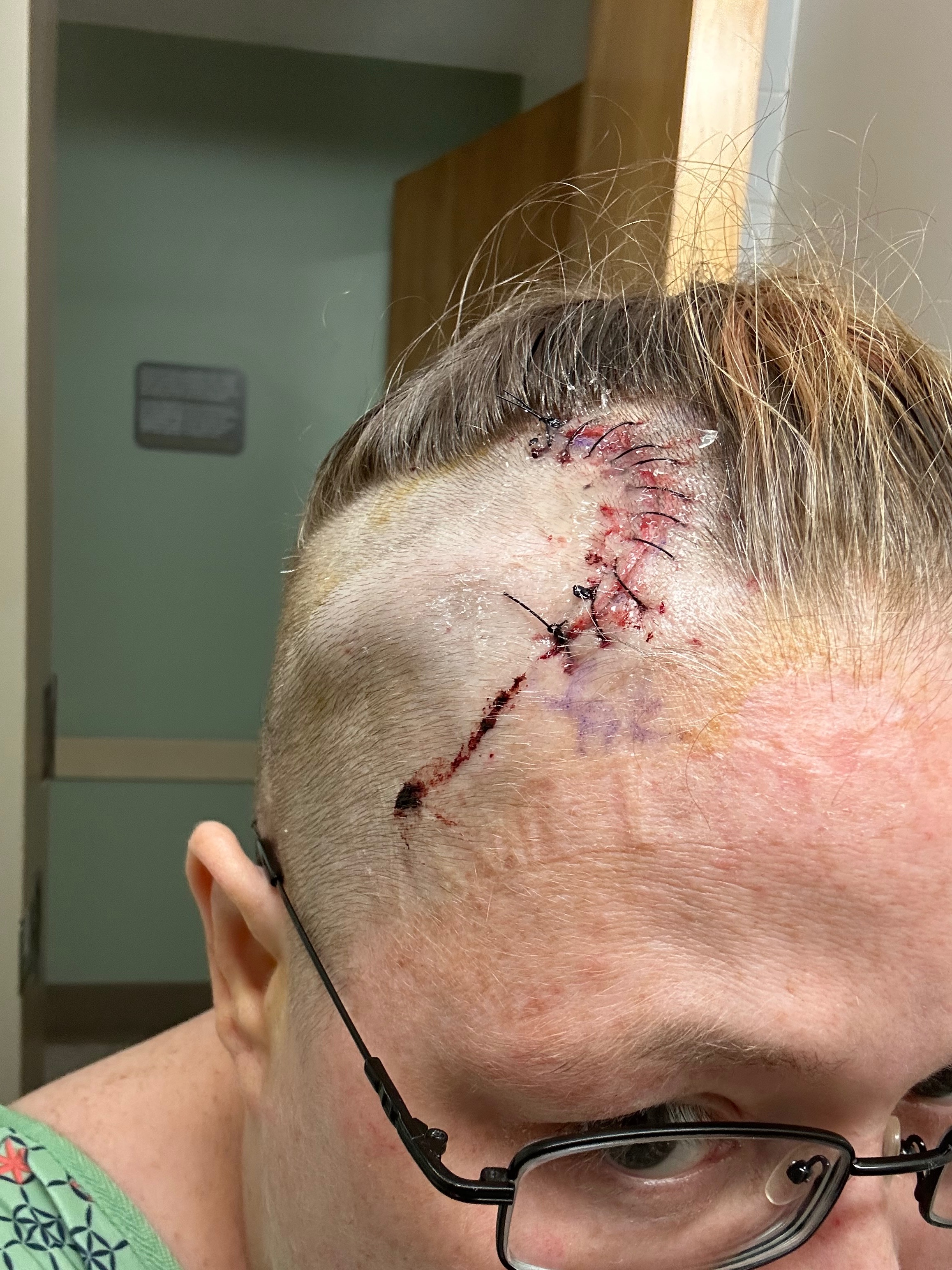 Please help with expenses while recovering from surgery campaign photo, 4 of 7