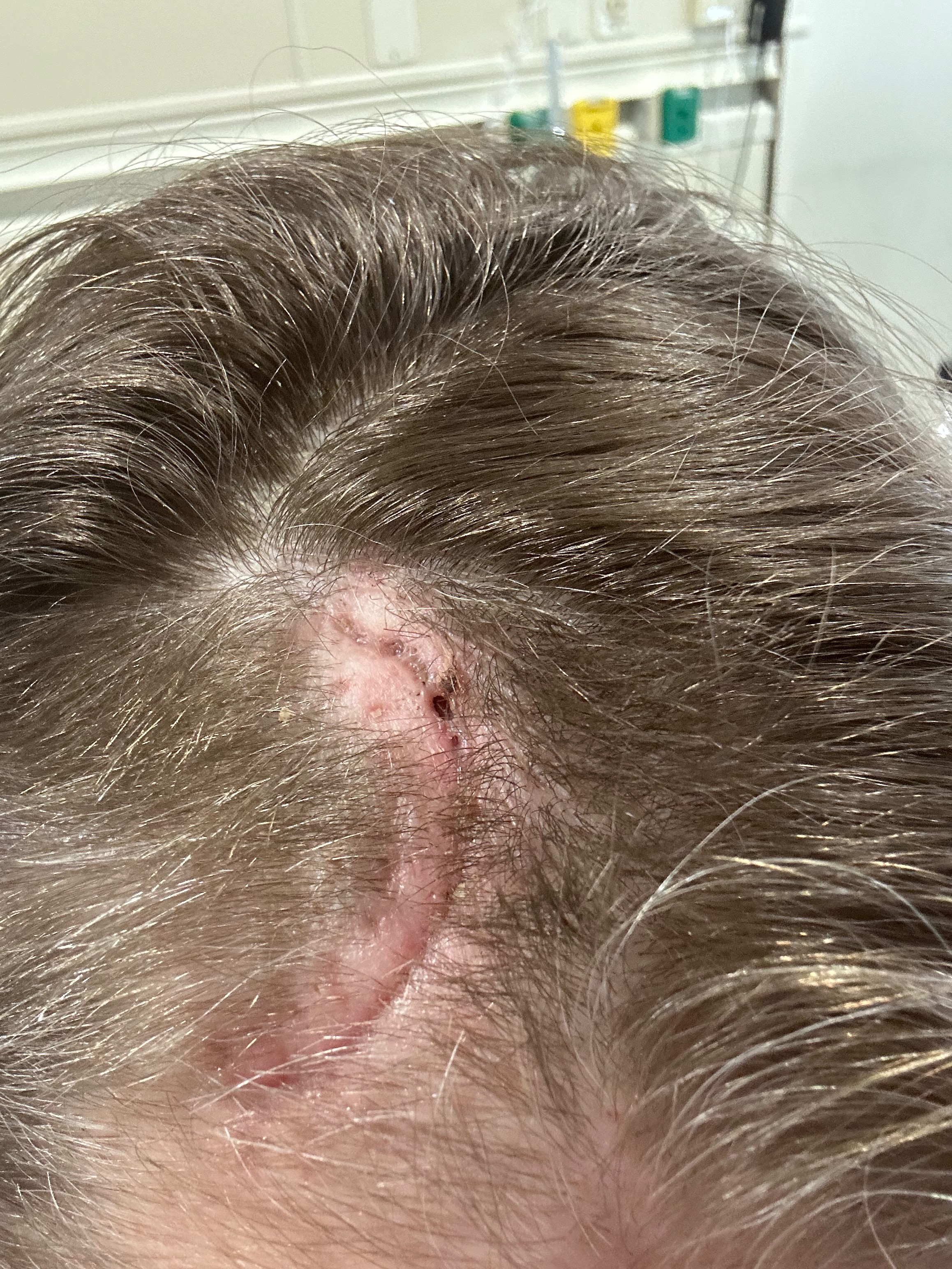 Please help with expenses while recovering from surgery campaign photo, 5 of 7