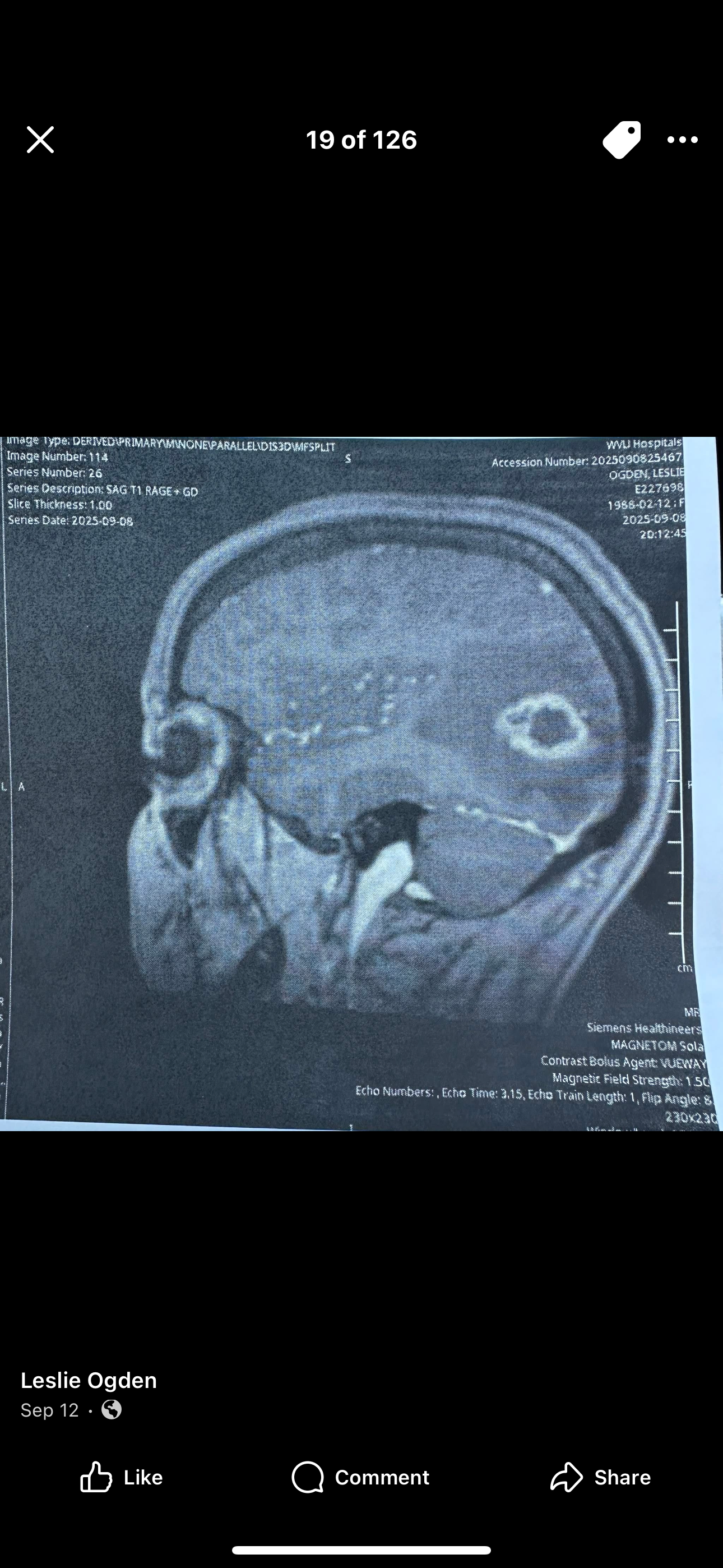 Support Leslie's Family After Brain Surgery campaign photo, 4 of 5