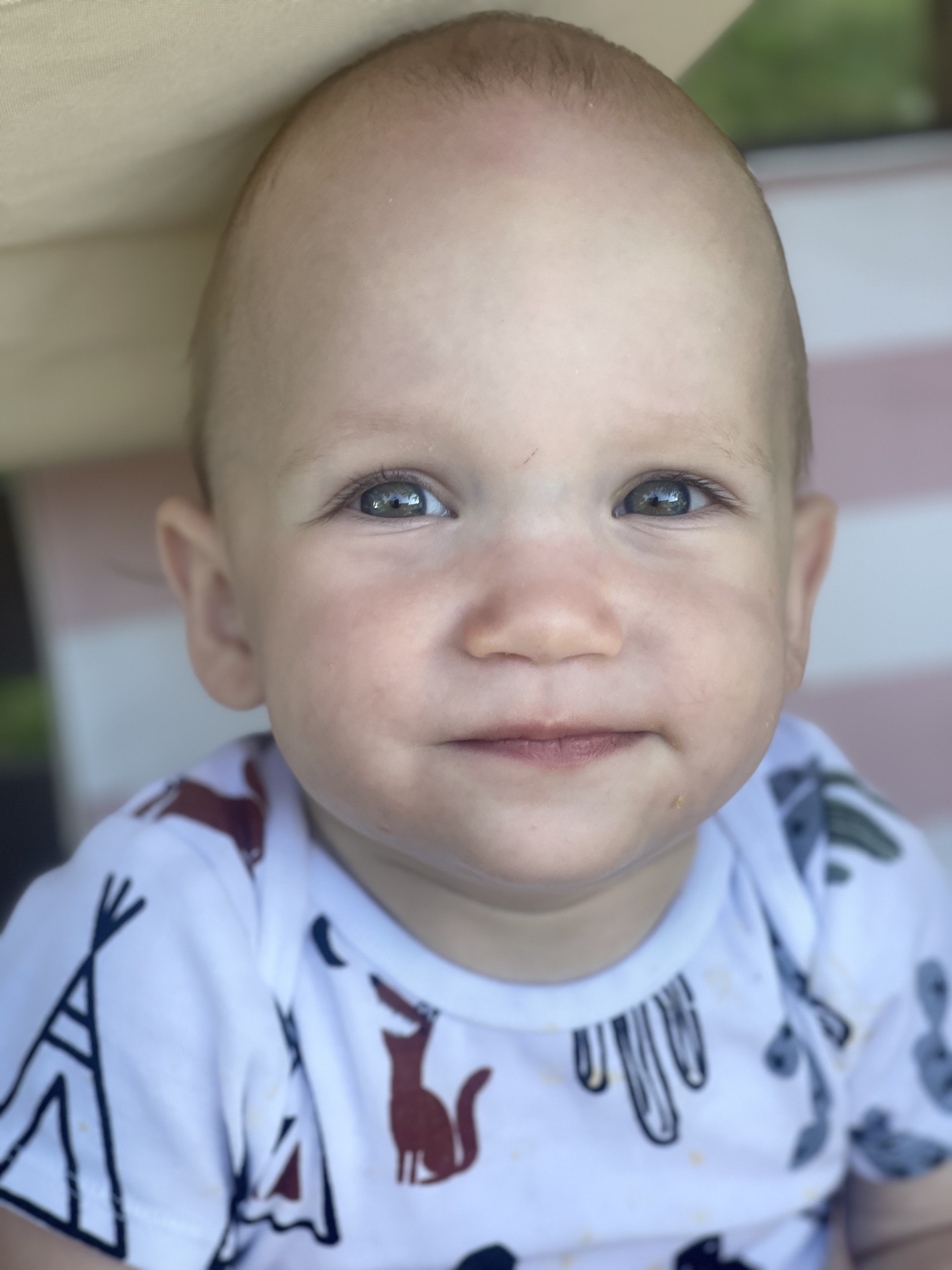 Please help Ledger and his family through cranial surgery campaign photo, 2 of 4