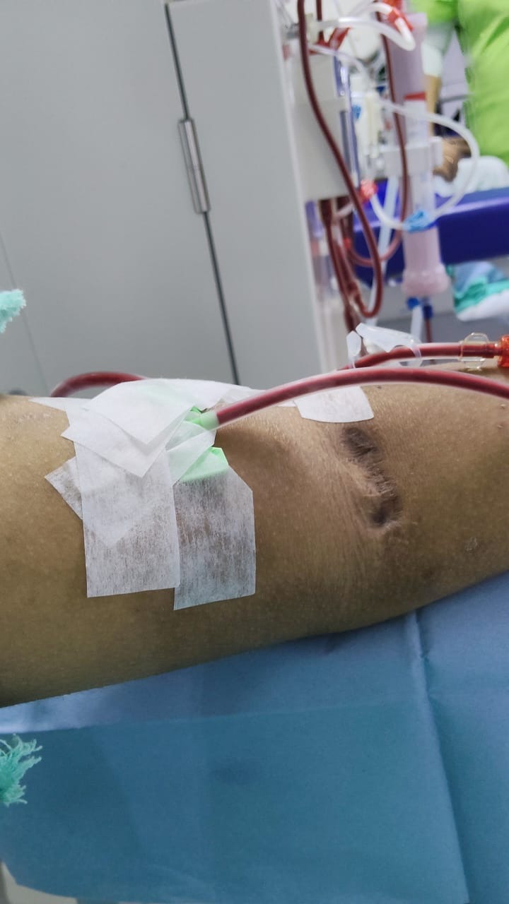 To get a kidney and leave hemodialysis campaign photo, 6 of 8